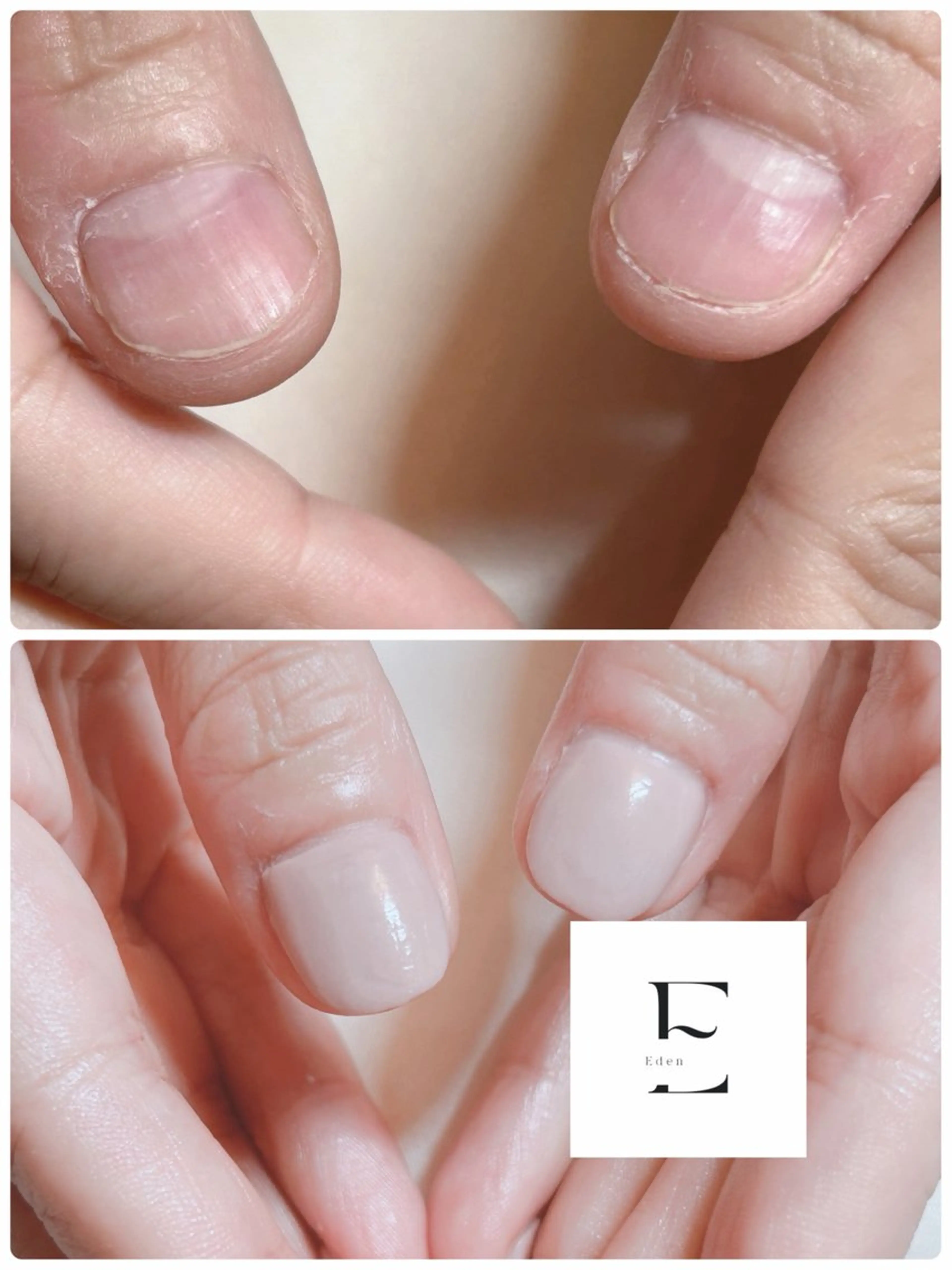 ネイル スカルプネイル 近藤 麻子のヘアスタイル