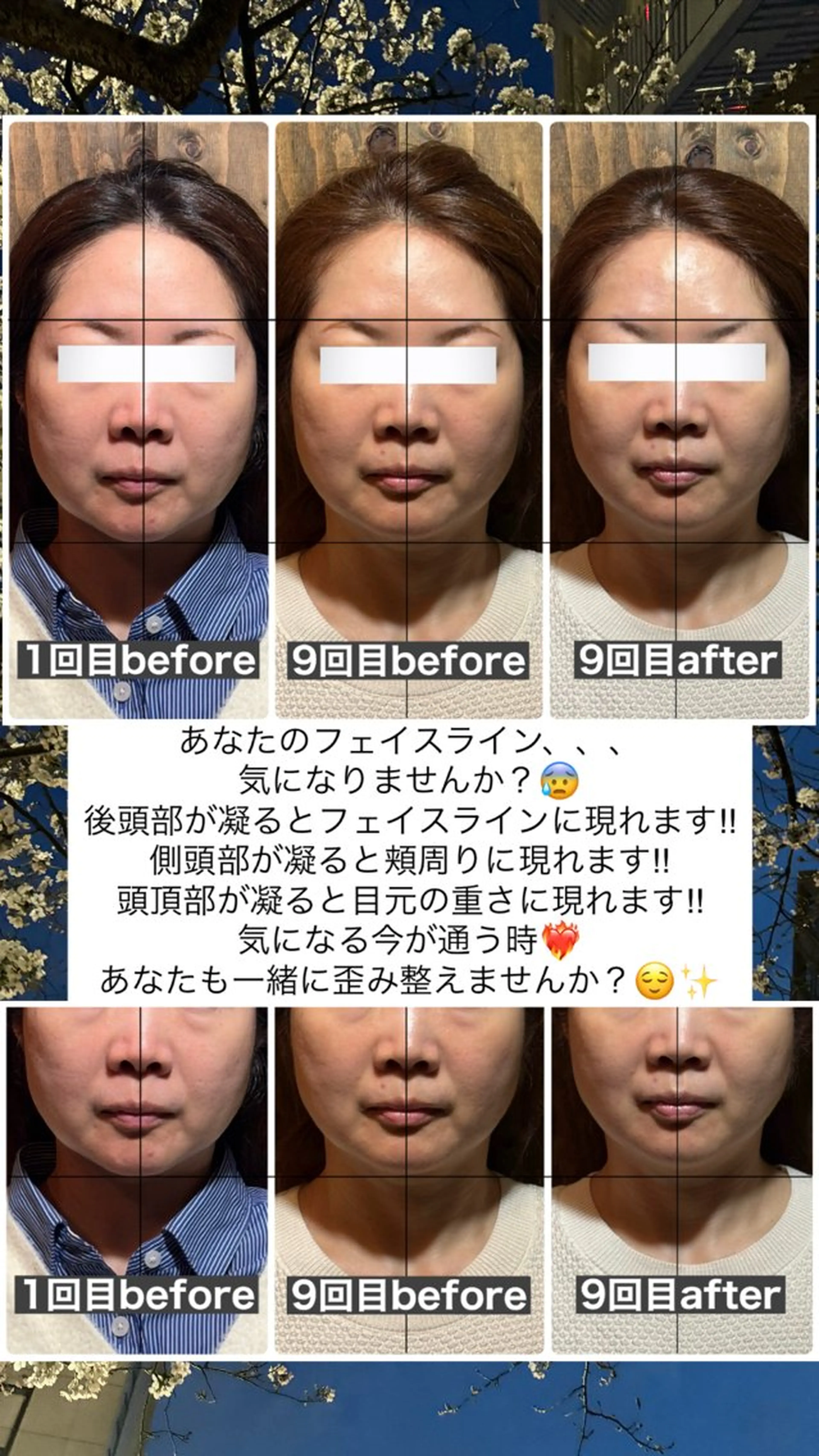 エステ リラク 💎後悔させない小顔 矯正💎イトヤマ🌱のエステ・リラクイメージ