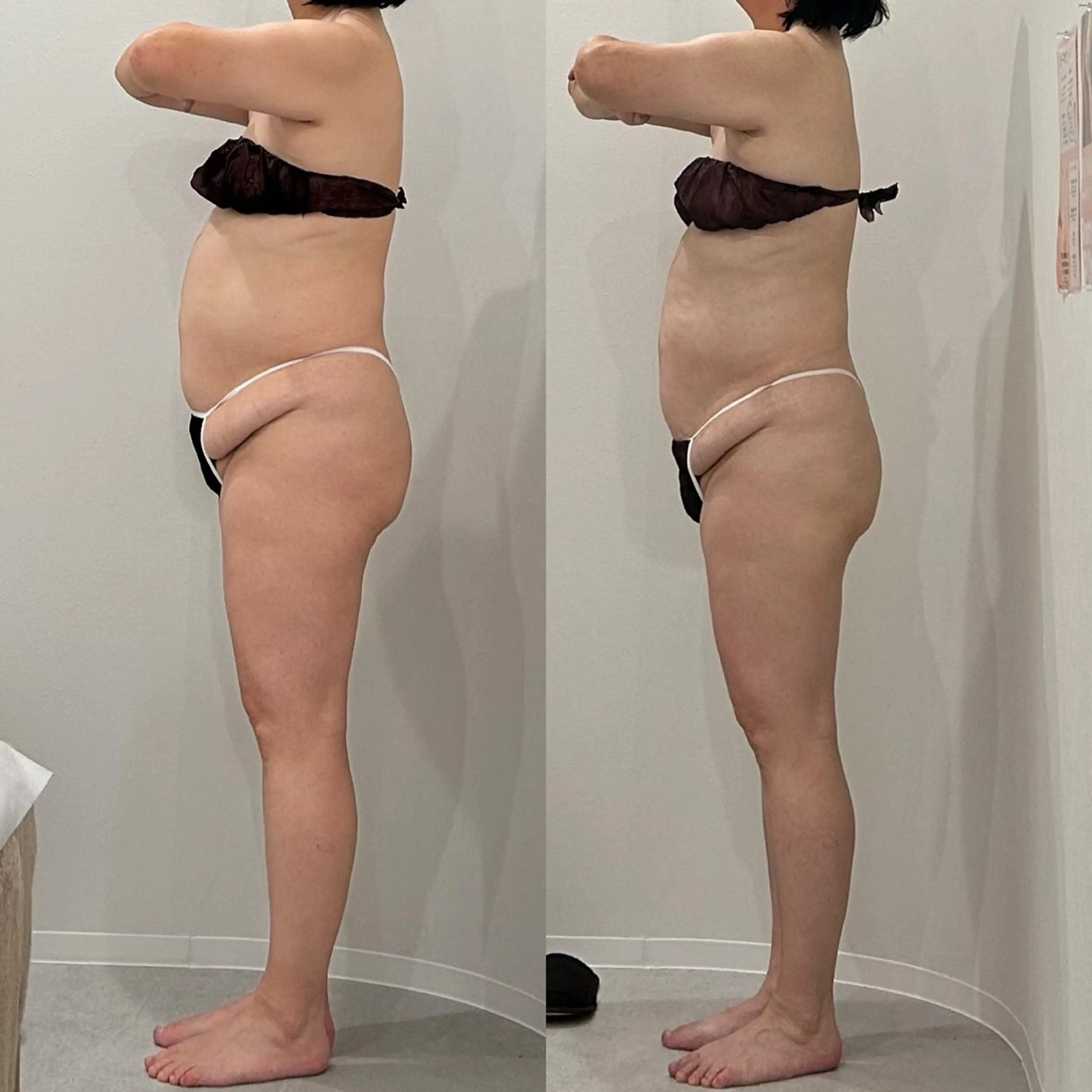 美容整体エステ　Asmy神戸板宿店所属・美容整体エステ ASMY神戸板宿店のエステ・リラクイメージ