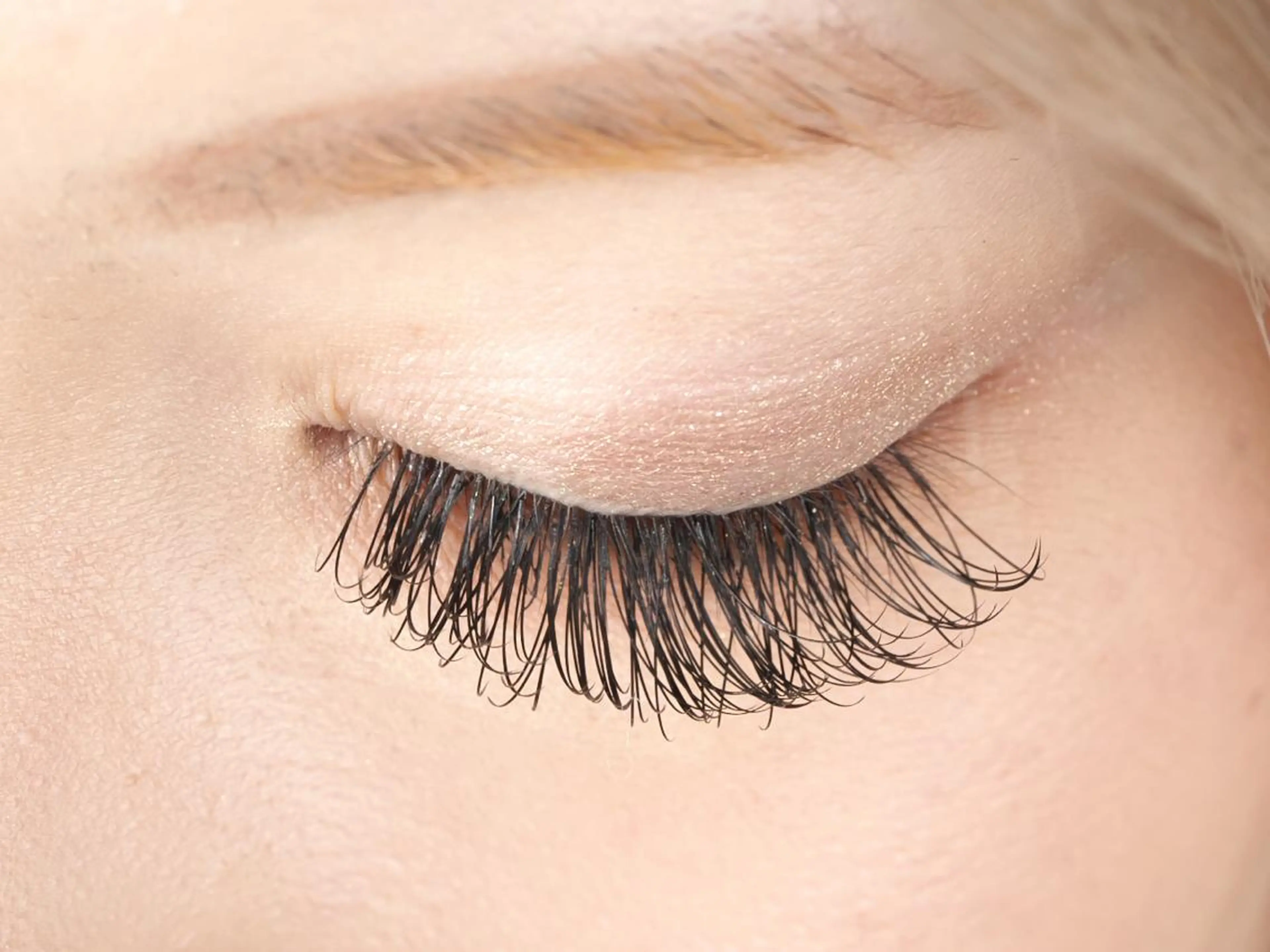 バインドロック140束の写真