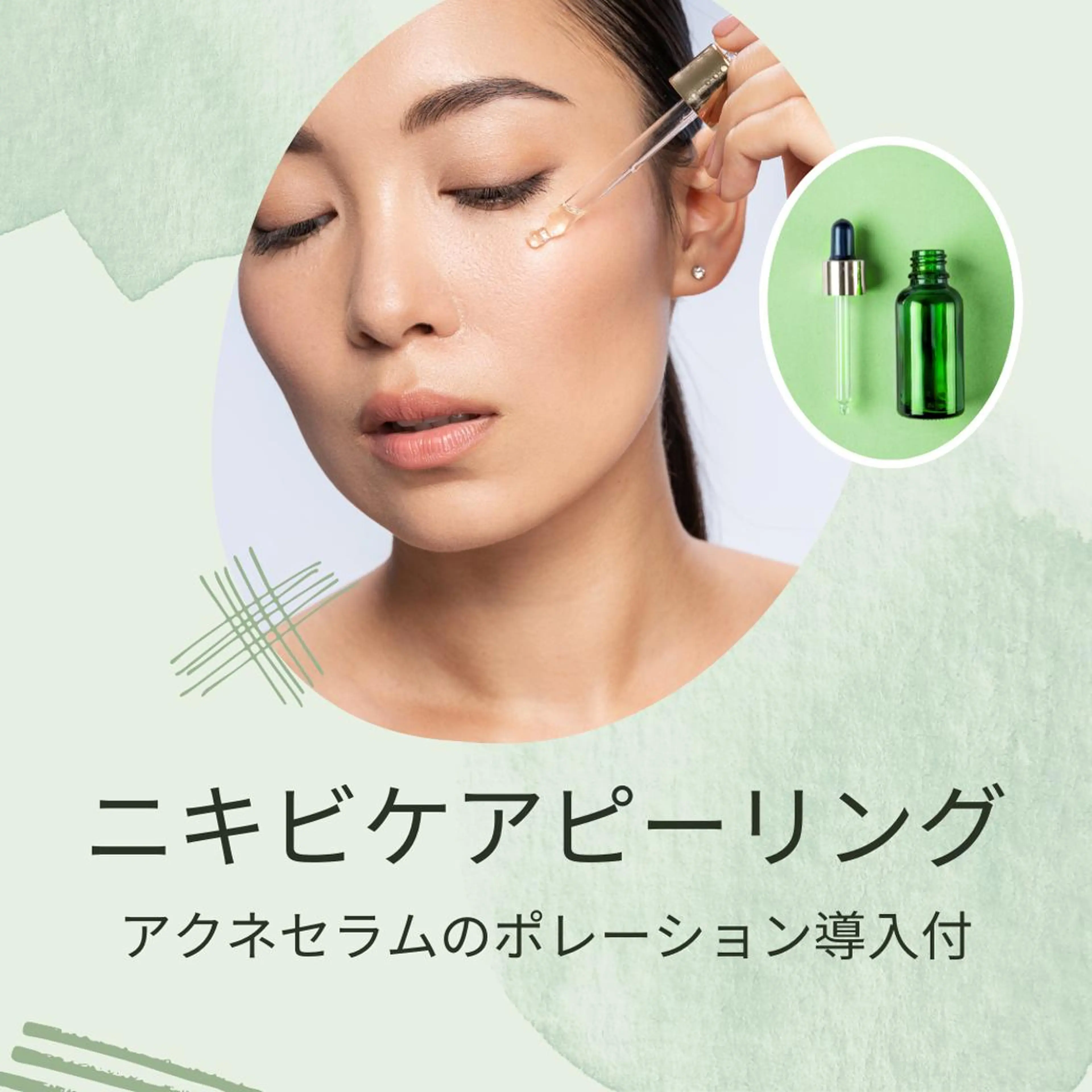 【毛穴・ニキビケア・肌質改善】ニキビケア乳酸ピーリング (剥離なし)＋アクネセラムポレーション導入の写真