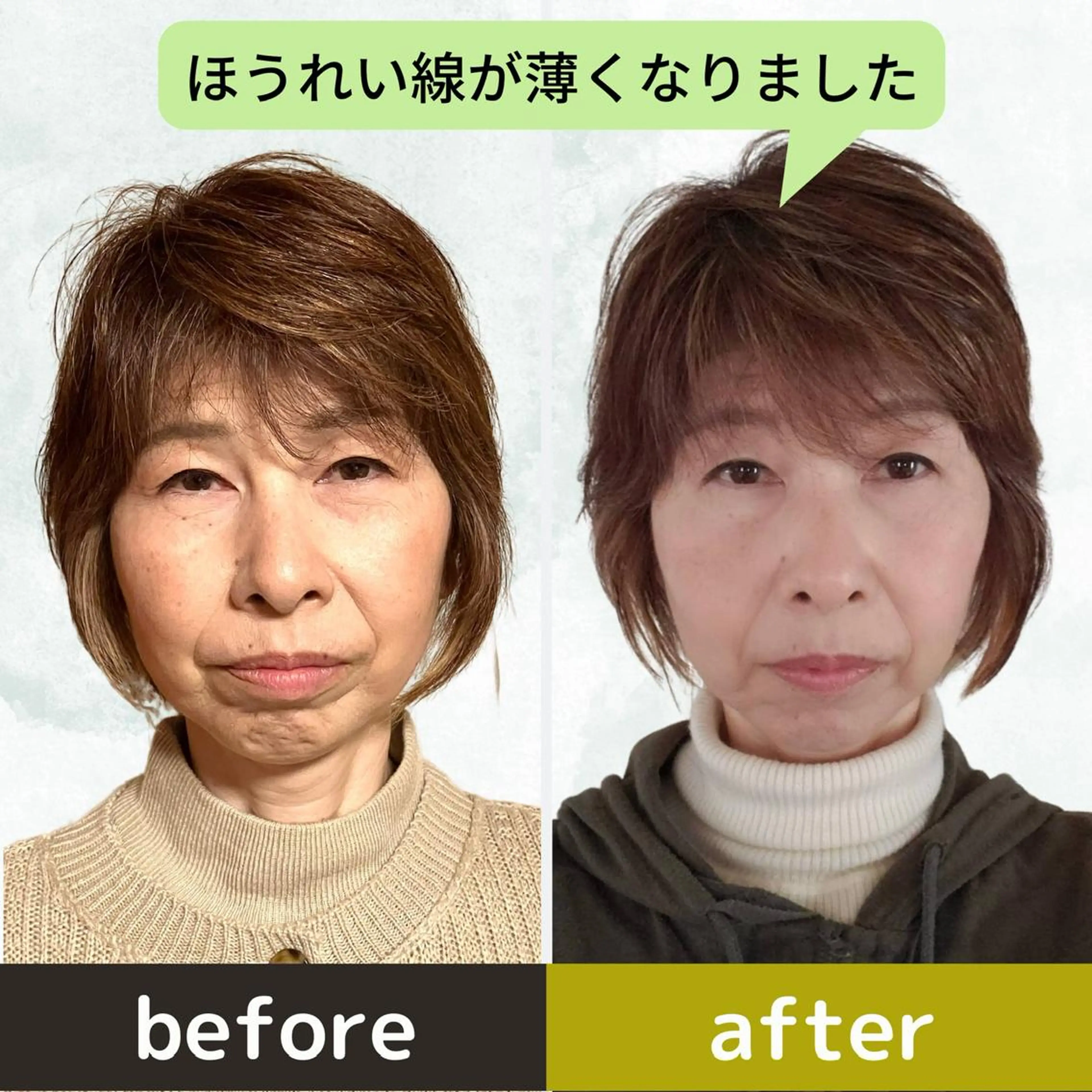 エステ リラク 小顔&ヘッドスパ/ もりもとまきみのエステ・リラクイメージ