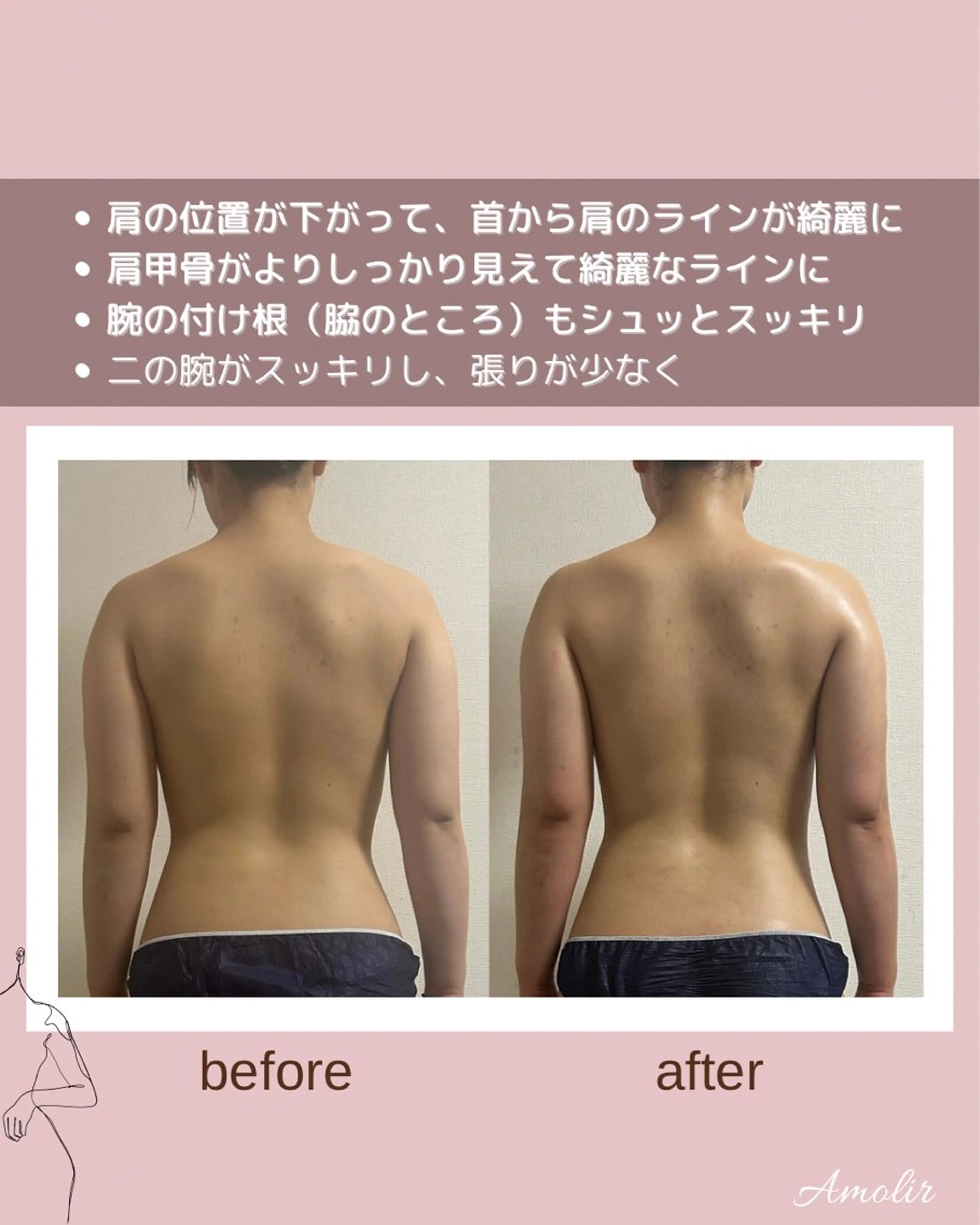 エステ リラク ボディメイクエステ Amolirのエステ・リラクイメージ