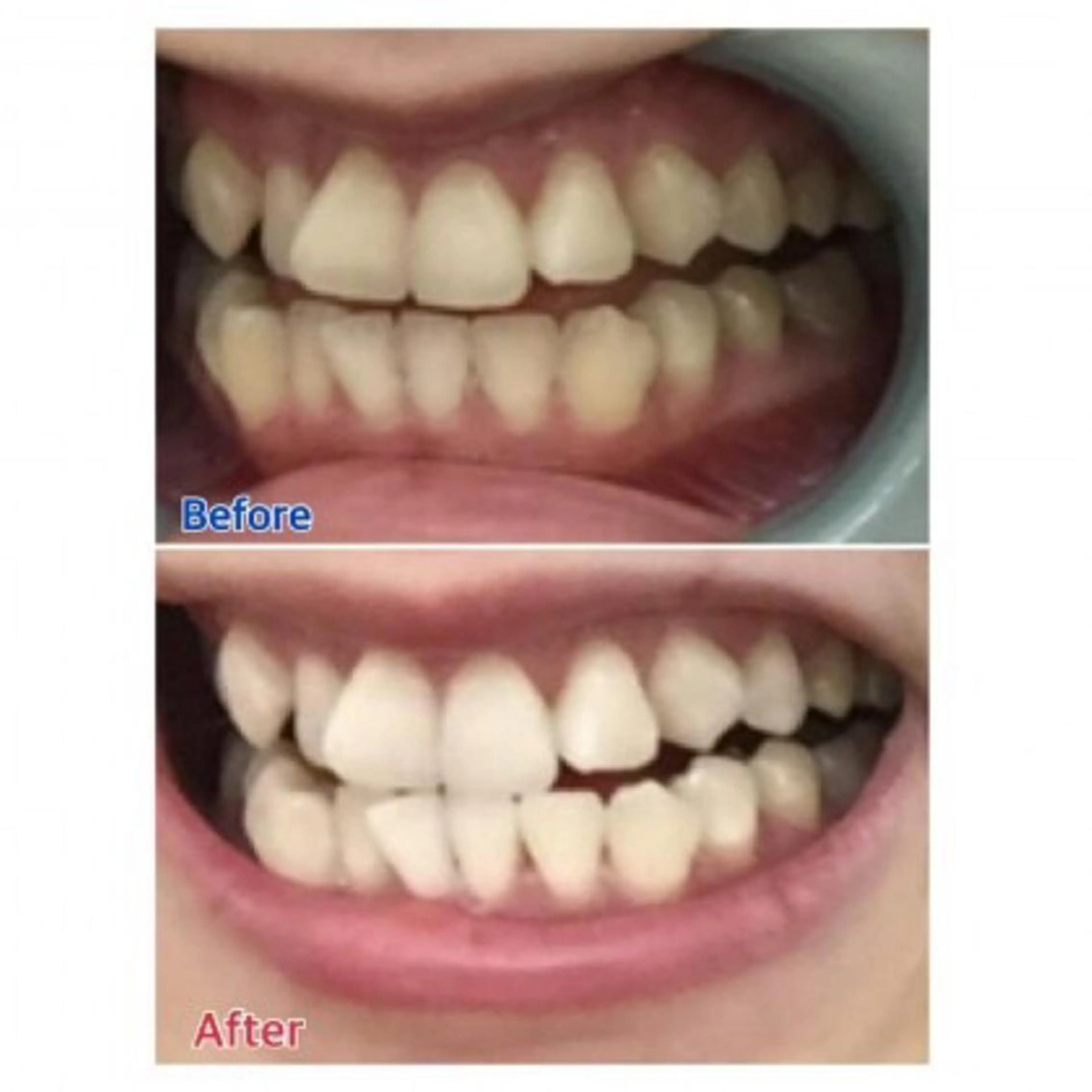 Ｍ渋谷 ホワイトニングのエステ・リラクイメージ