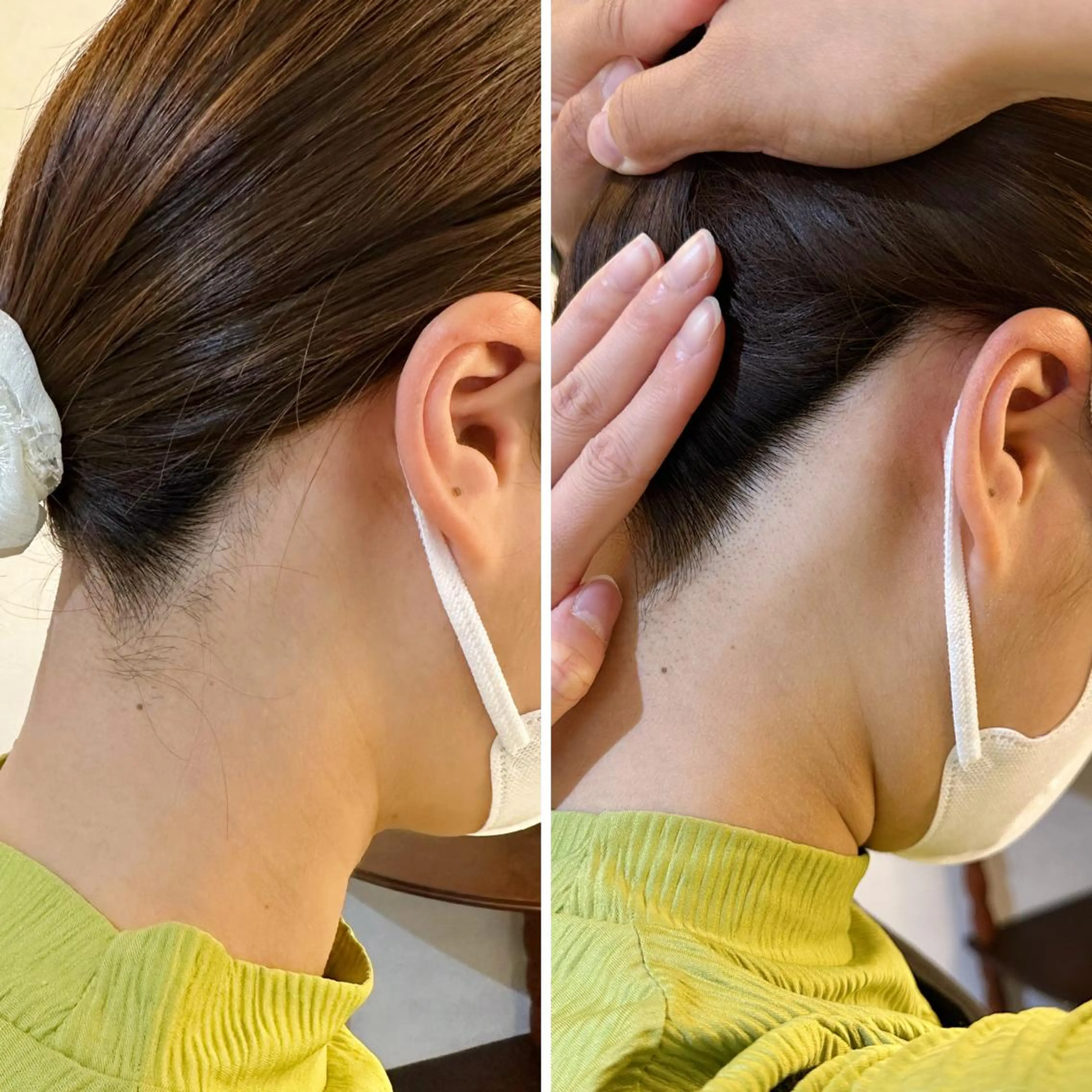 うなじ脱毛/美肌脱毛 LABELのエステ・リラクイメージ