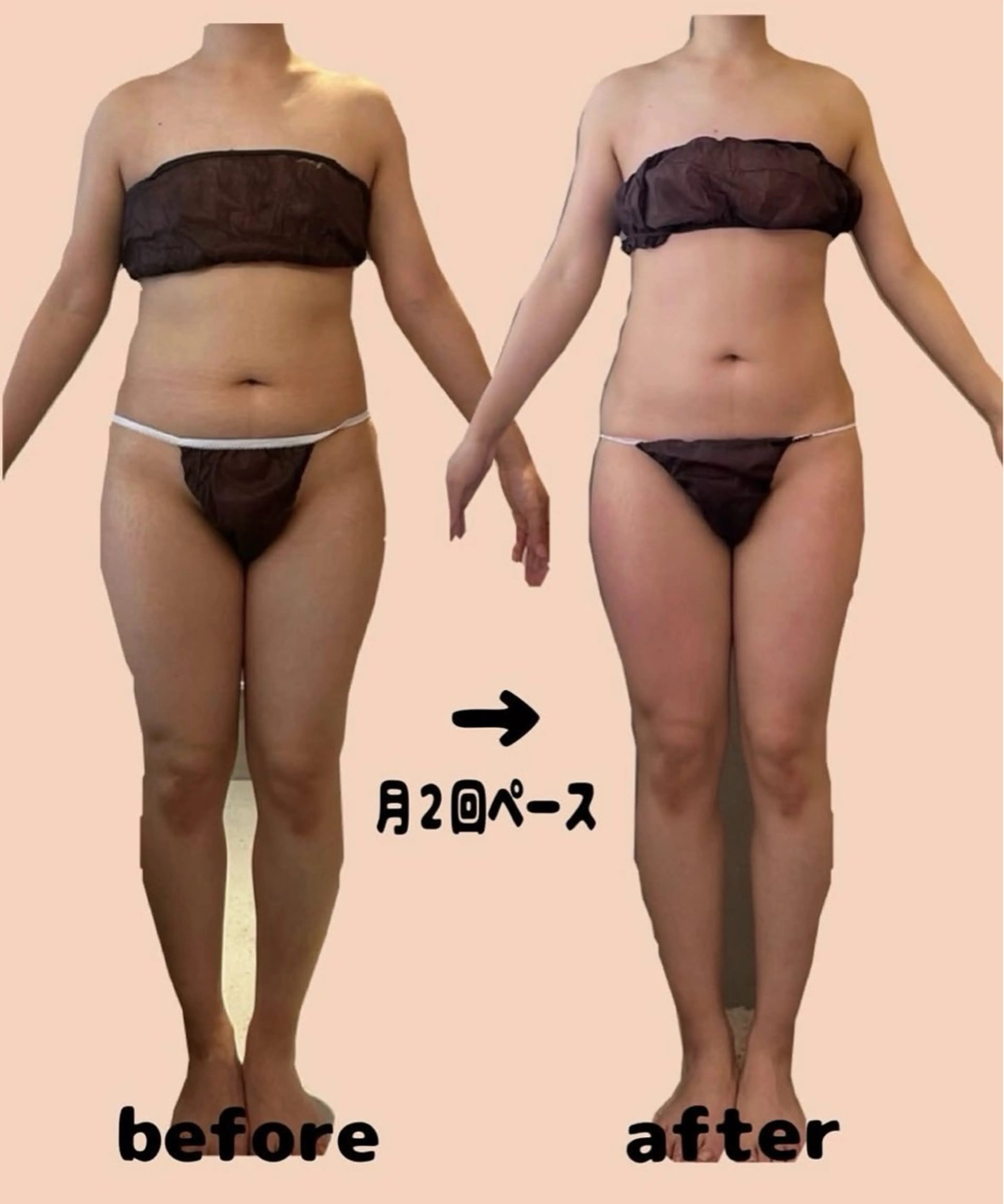 エステ asmy 西梅田店のエステ・リラクイメージ