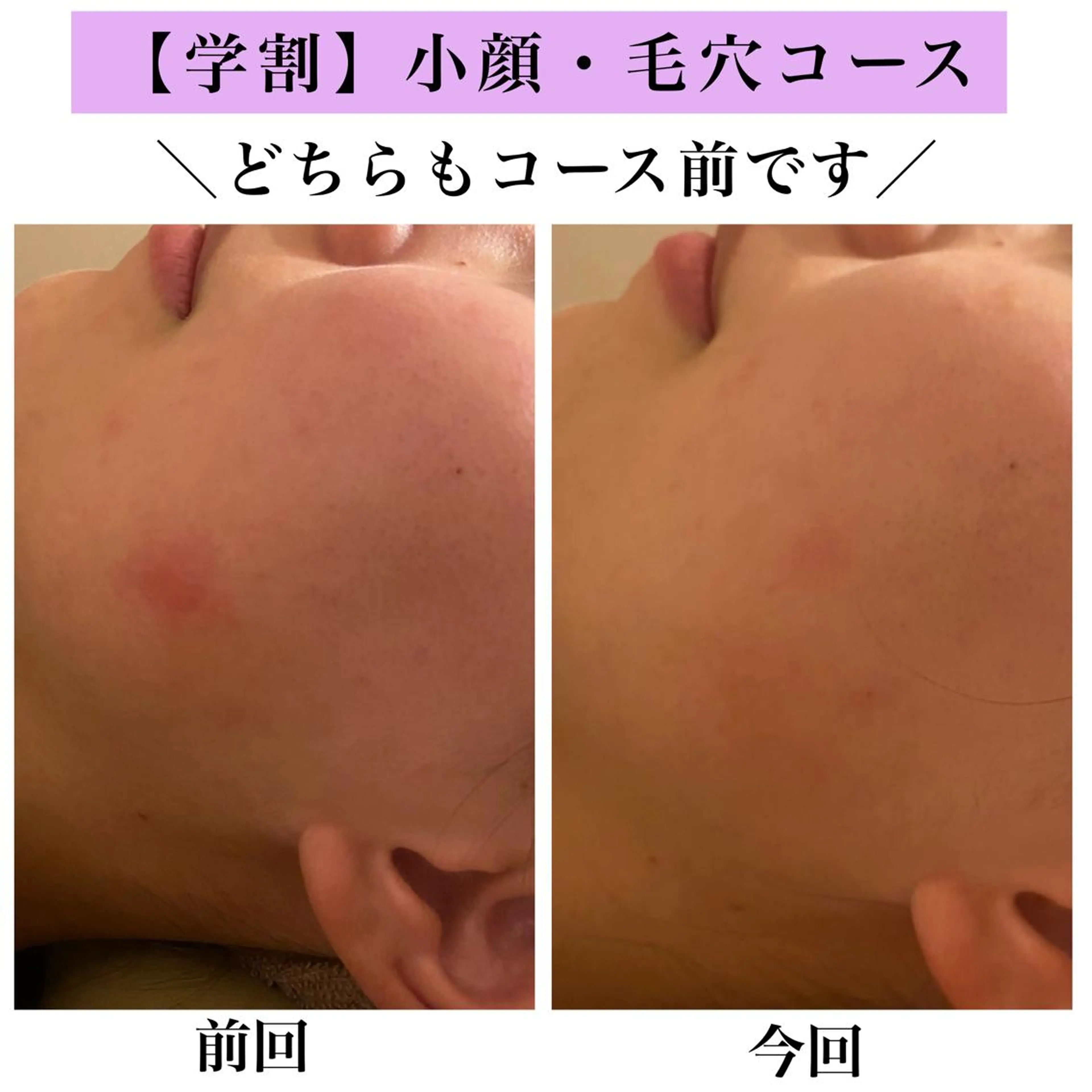 Bellesthe （ベルエステ）のエステ・リラクイメージ