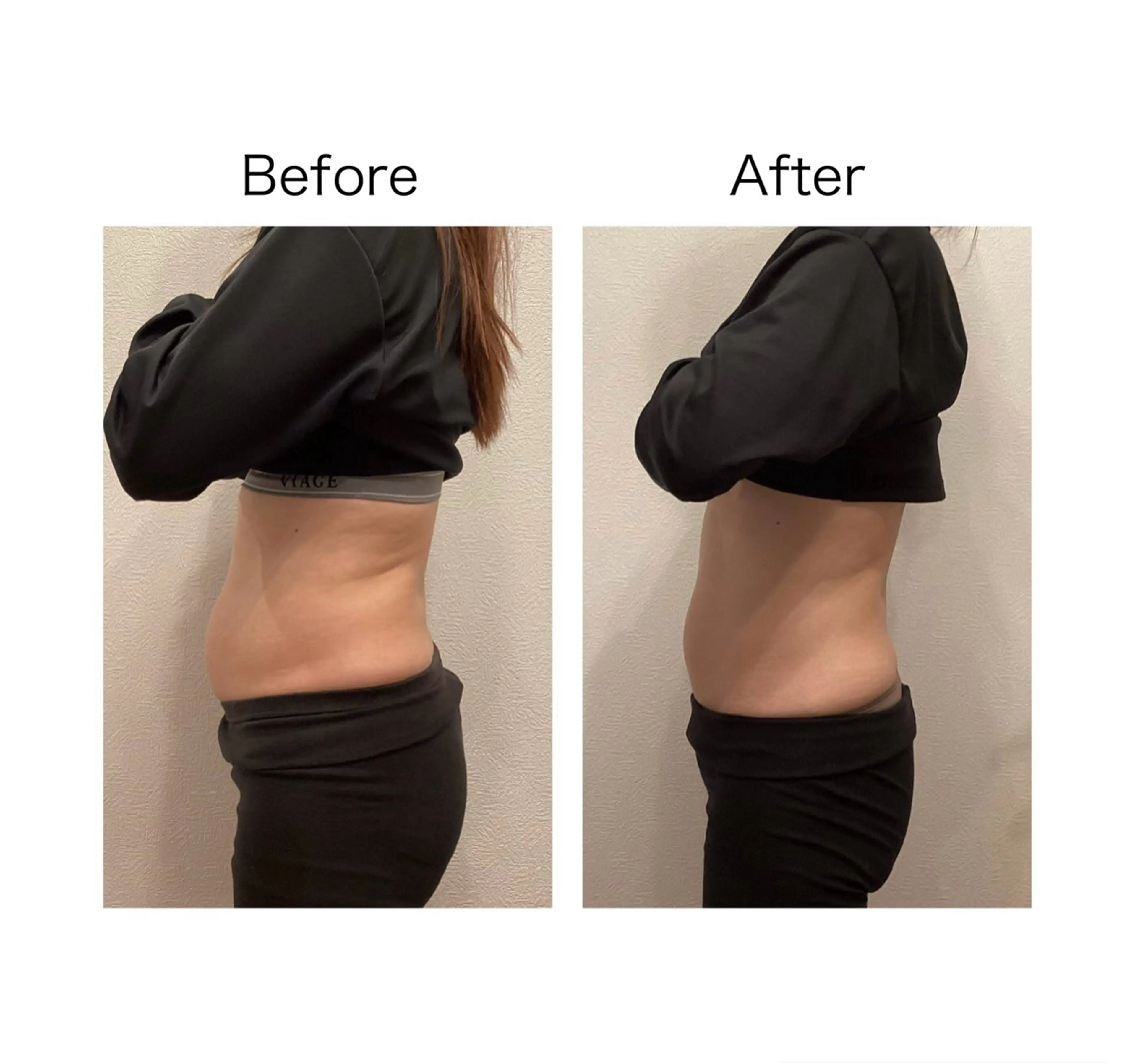 エステ リラク 小顔サロン sharpのエステ・リラクイメージ