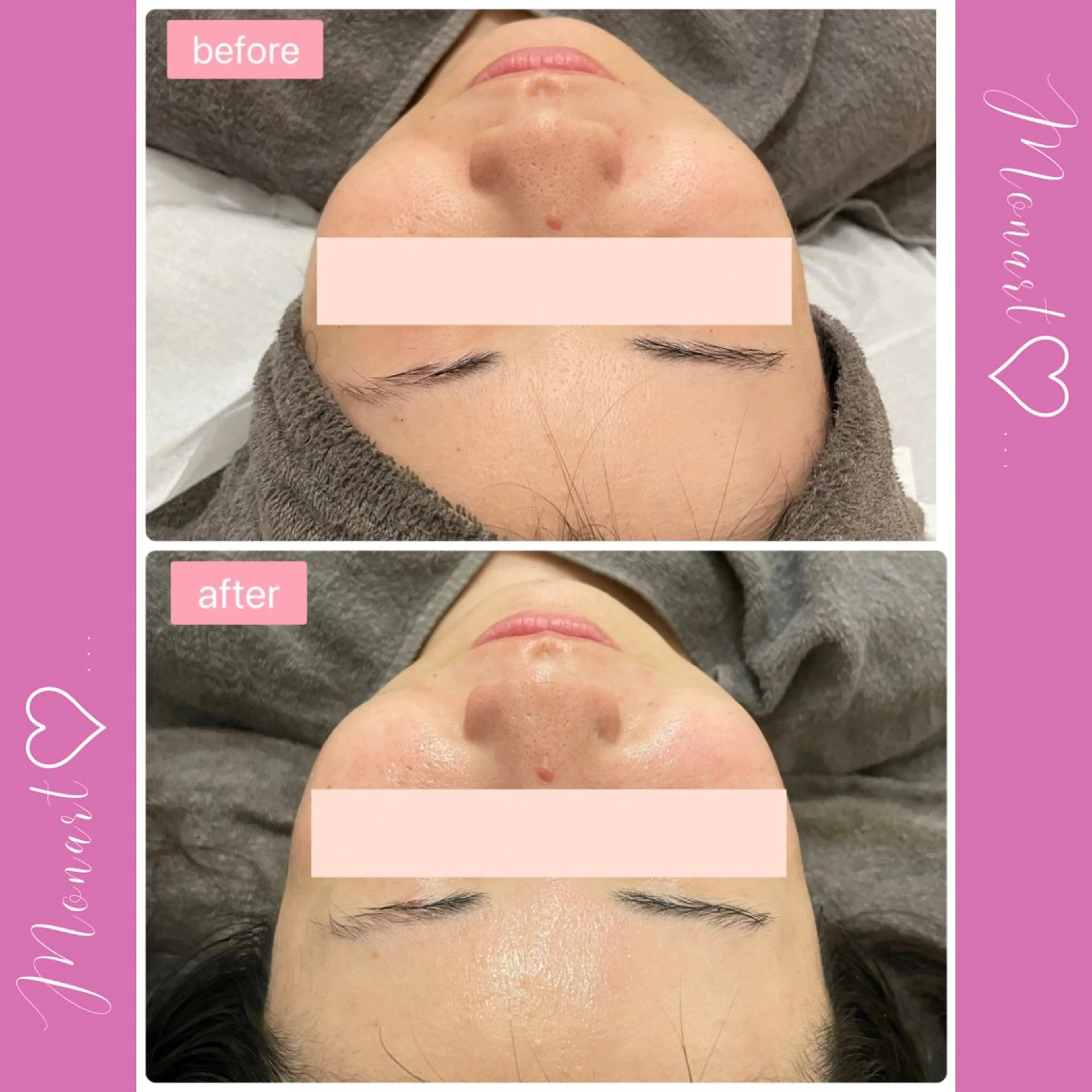 Monart -deux-のエステ・リラクイメージ