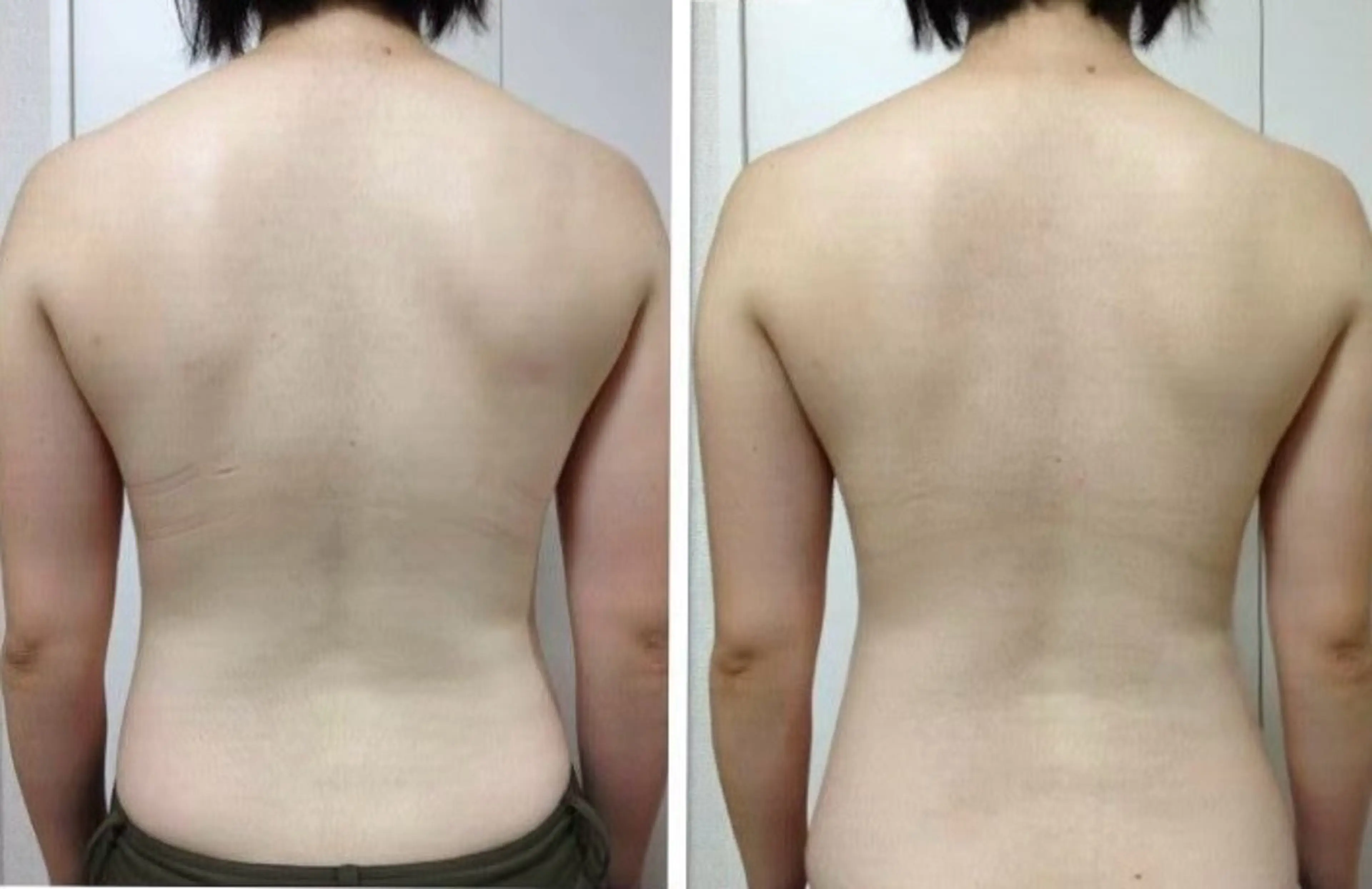 snipper横浜西口店所属・🌻こみや せいか🌻のエステ・リラクイメージ