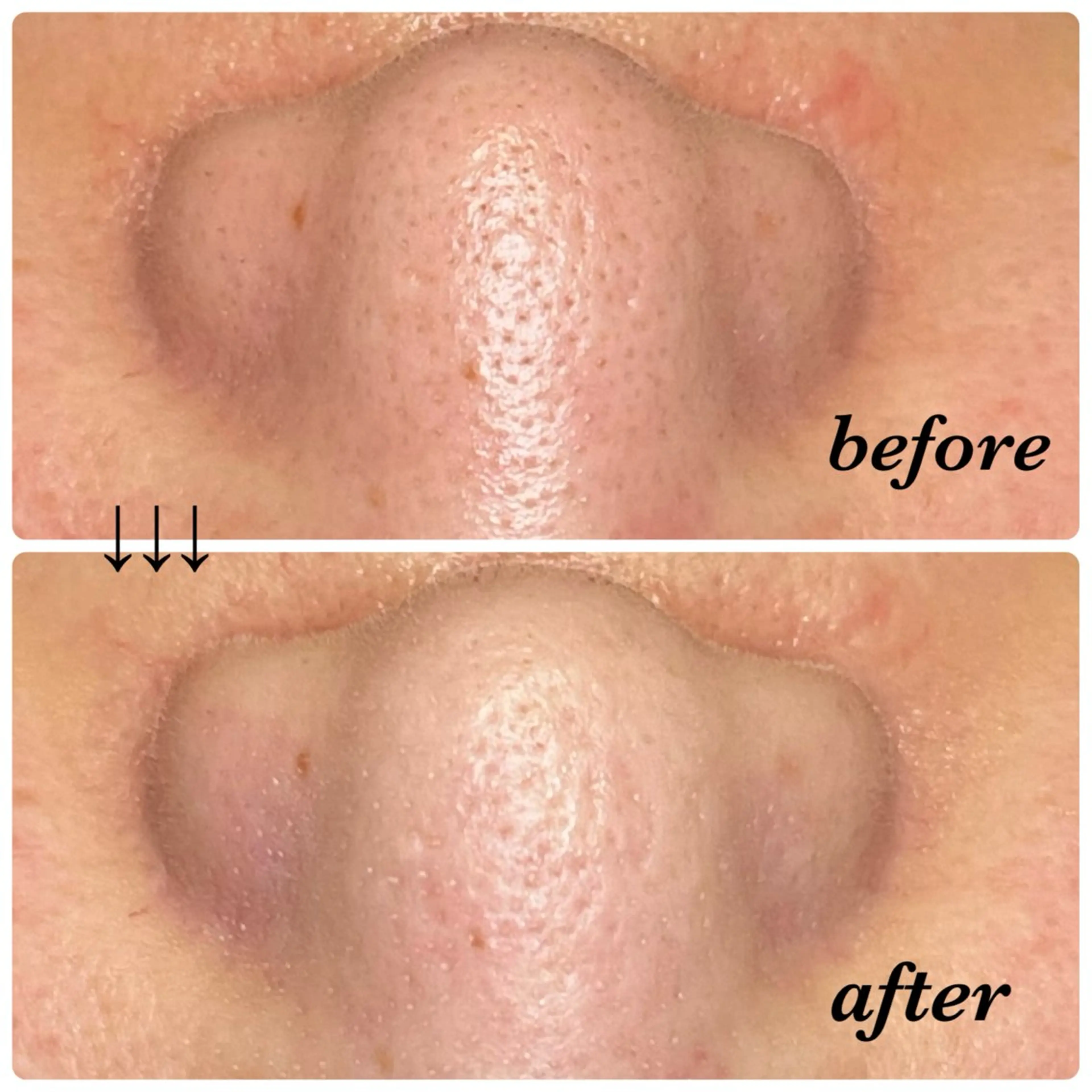 salon akua nail＆リラクのマツエク・マツパデザイン