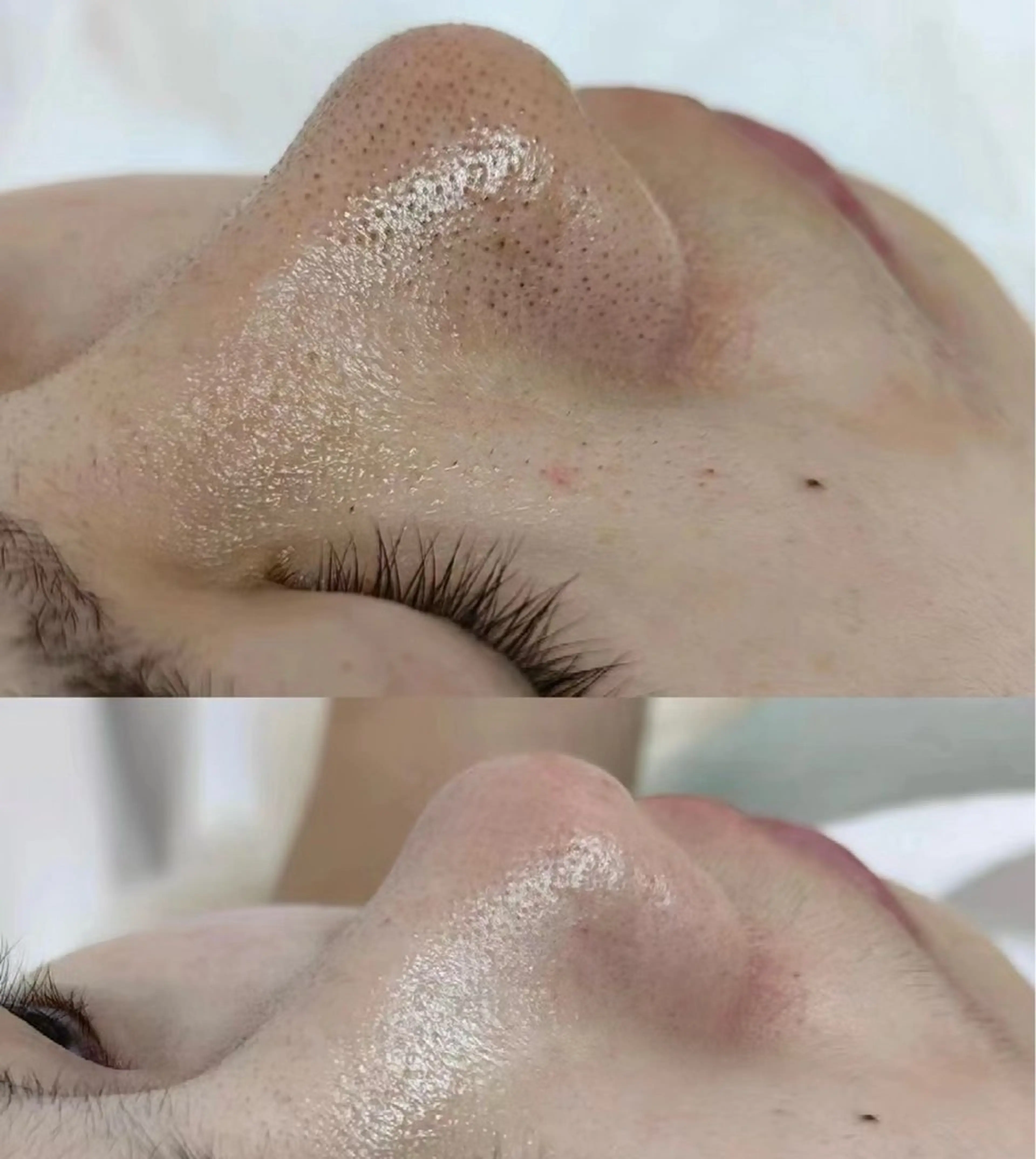 マツエク・マツパ エステ aliaハーブ水光店 エステティシャン募集のエステ・リラクイメージ