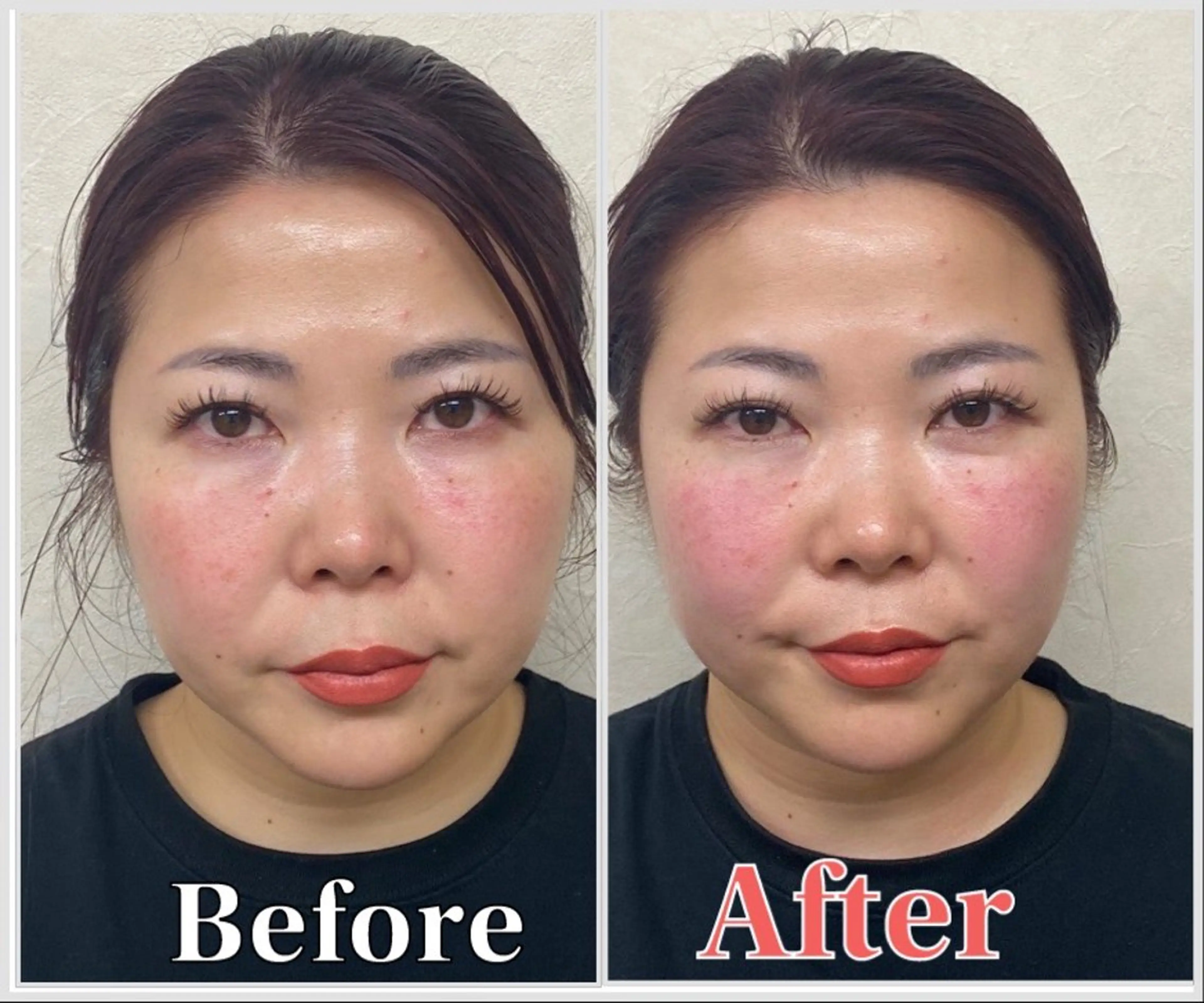 整体 LALUZ中目黒のその他イメージ