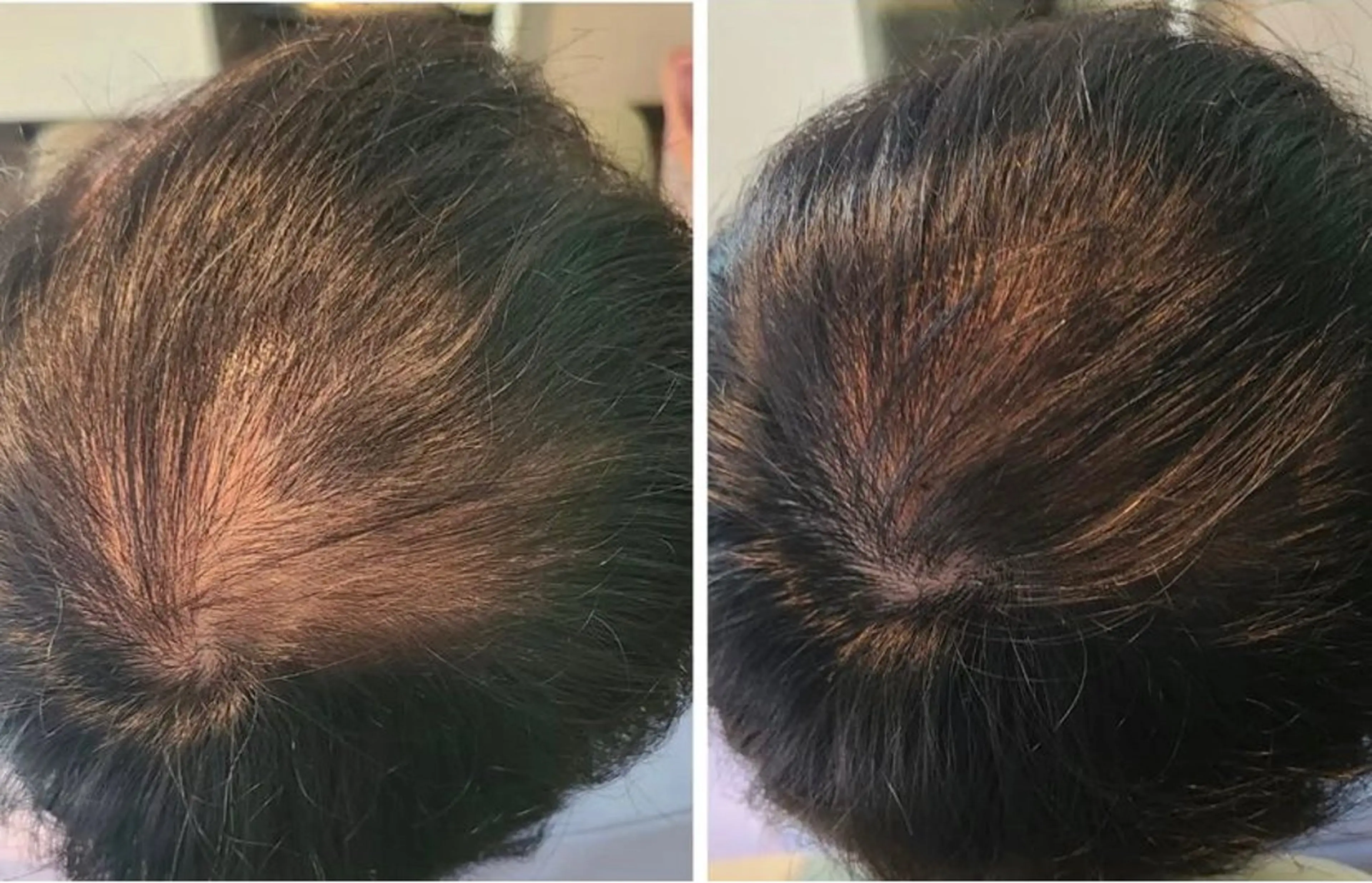 ボリュームコース　増毛600本の写真