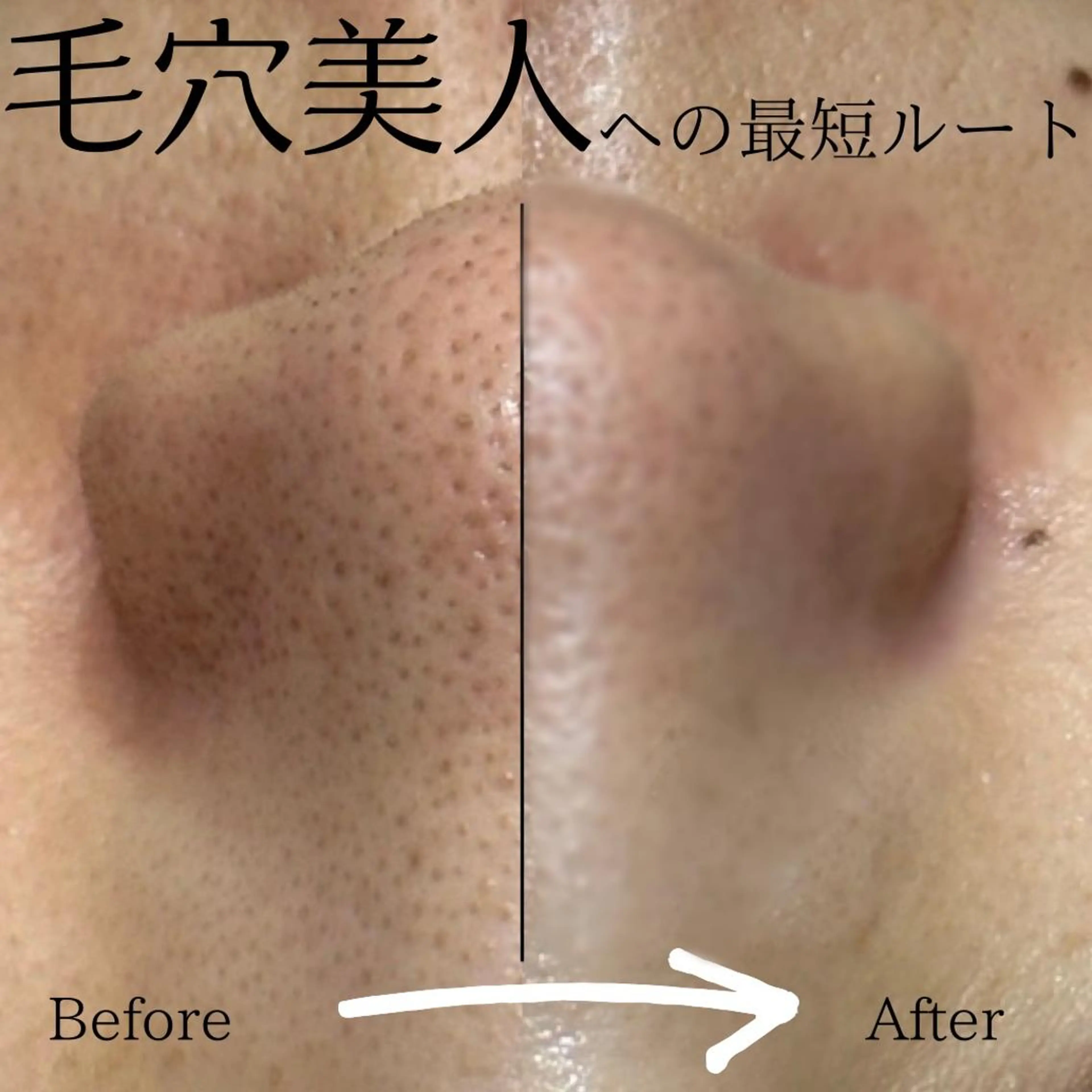 🌷毛穴エステ レイビスMURA🌷のエステ・リラクイメージ