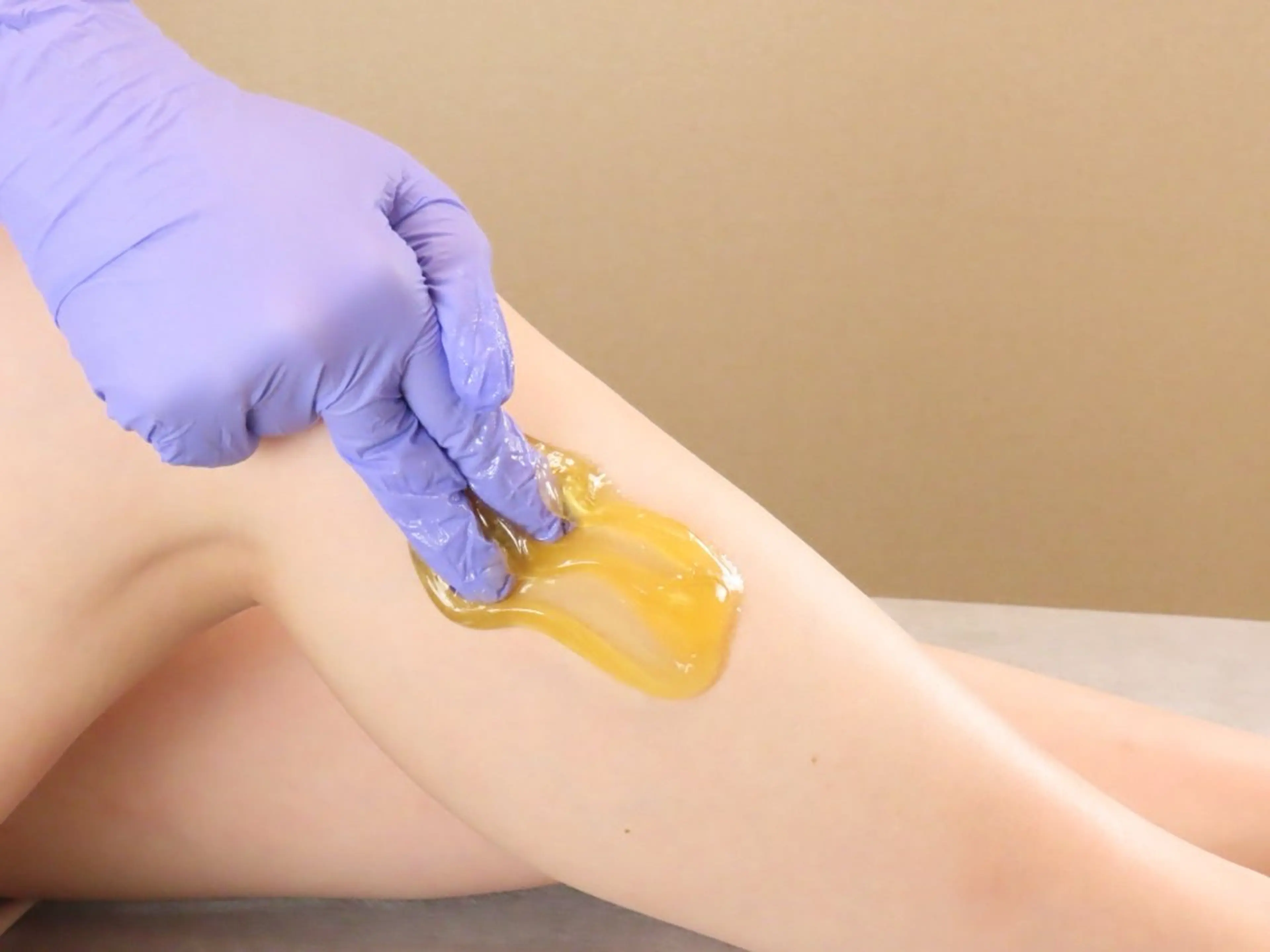 【ladies】Sパーツ/シュガーリング+光脱毛の写真