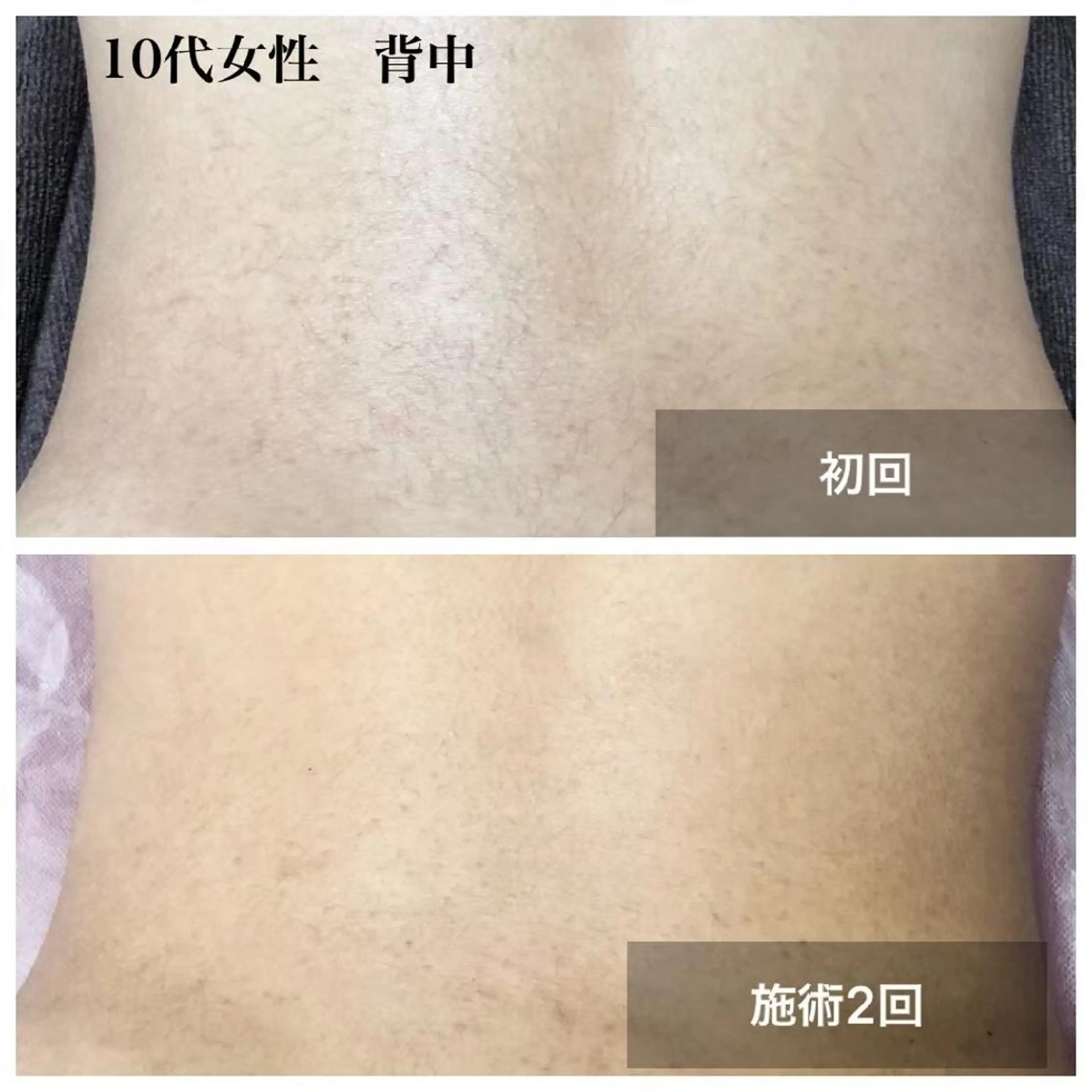 美容＆脱毛サロン 金沢文庫のエステ・リラクイメージ