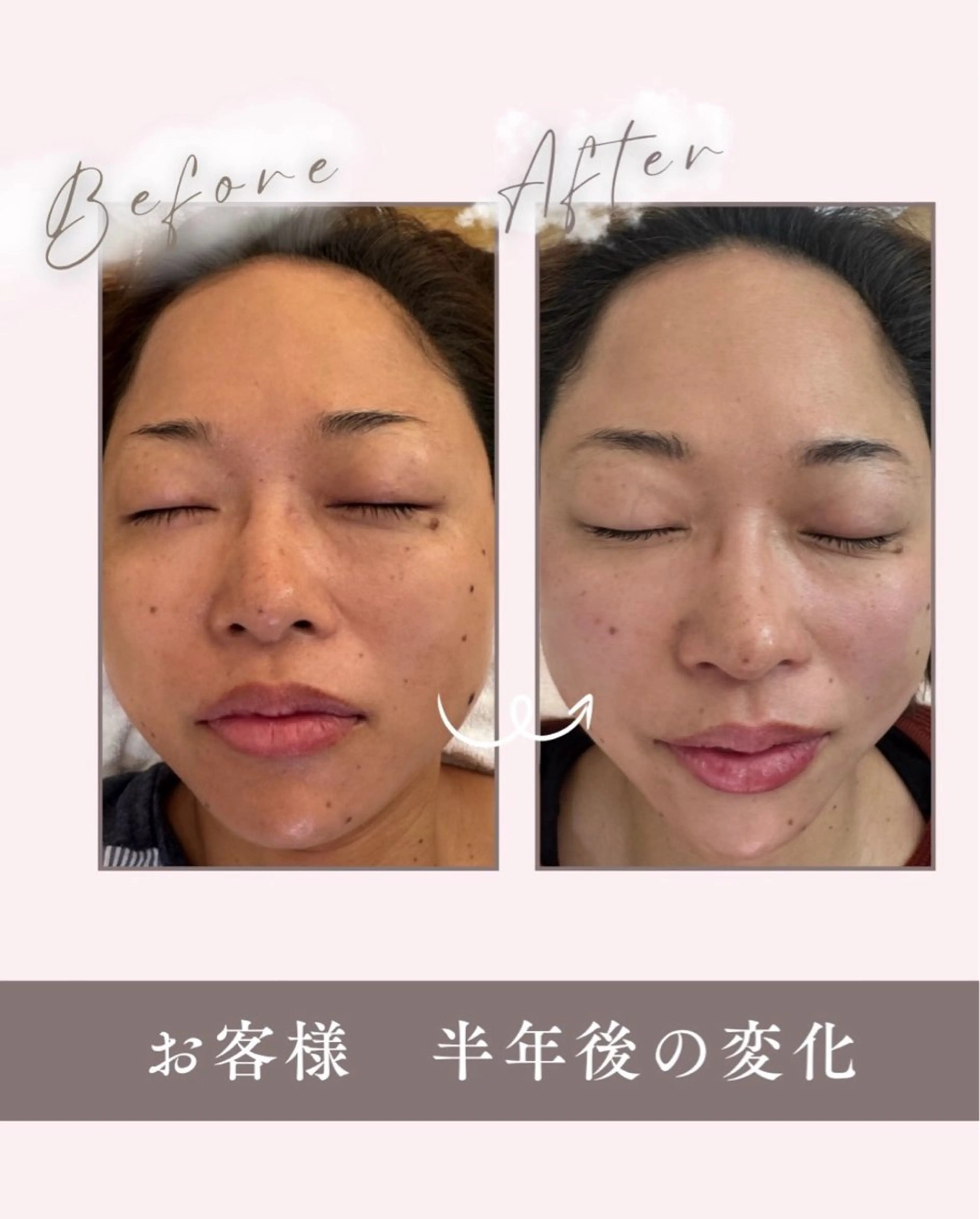 CPサロン LUANA所属・前田 季美のエステ・リラクイメージ