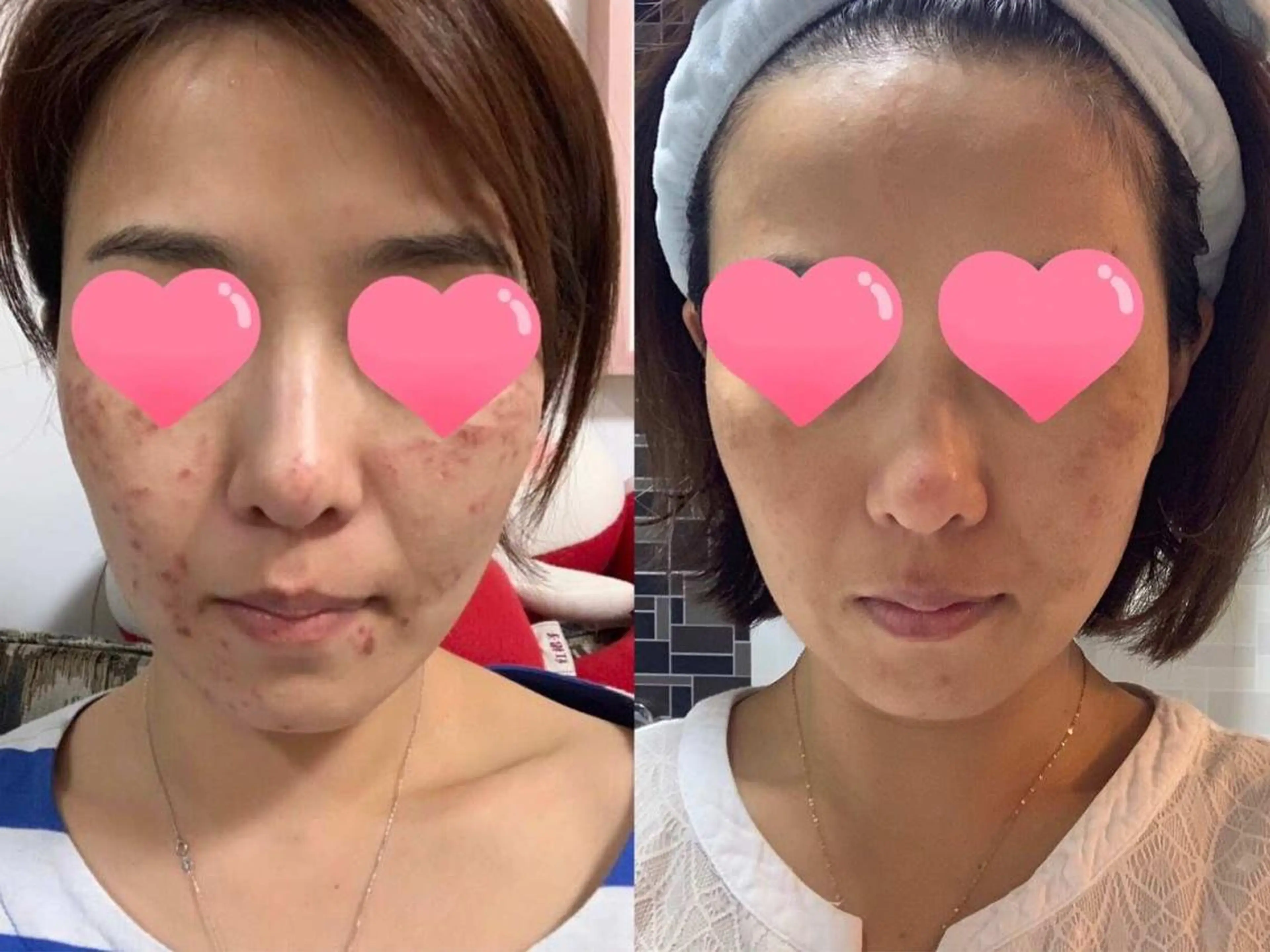 OPREA 栄店のエステ・リラクイメージ