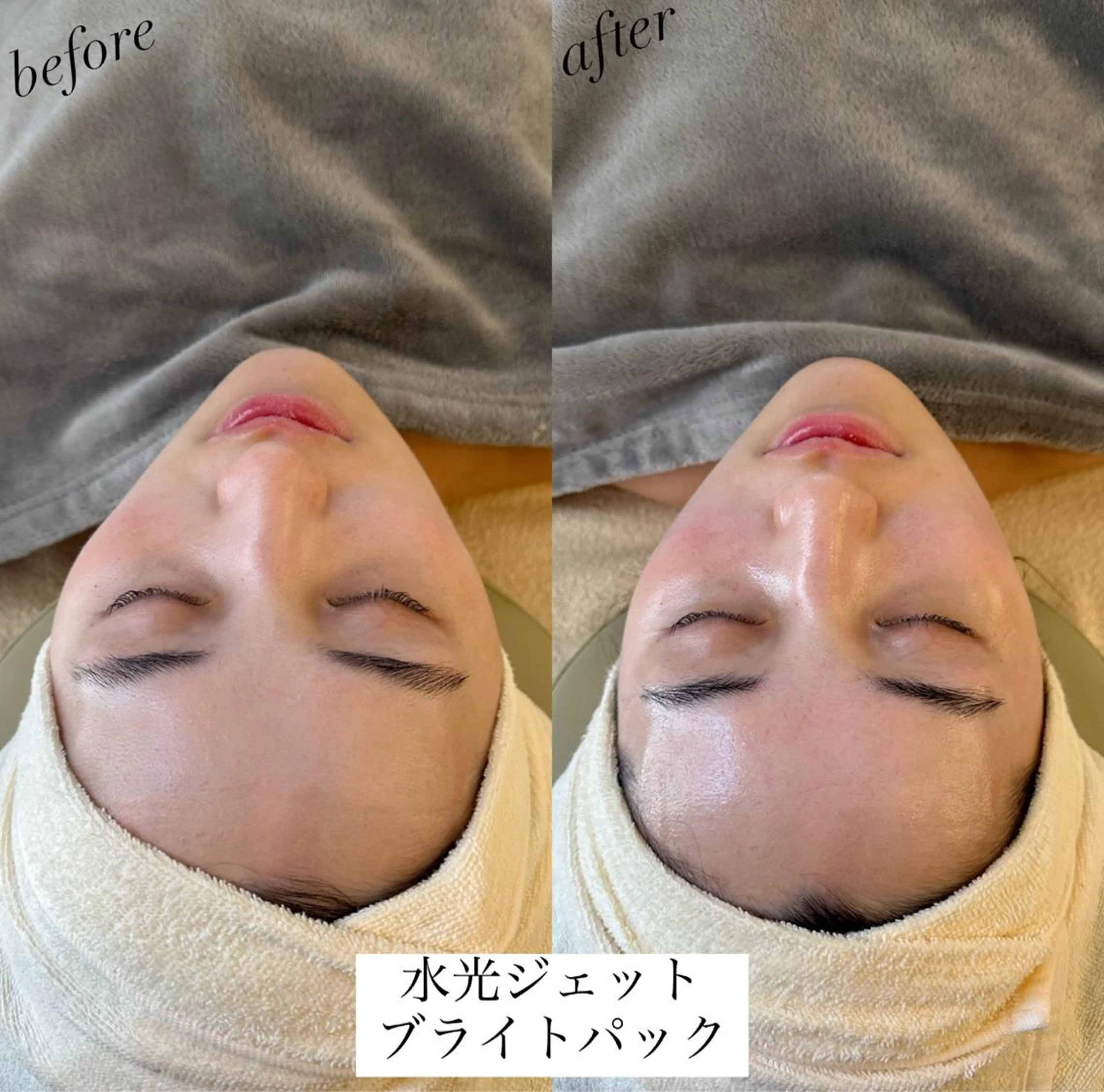 エステ うなじ脱毛/美肌脱毛 LABELのエステ・リラクイメージ