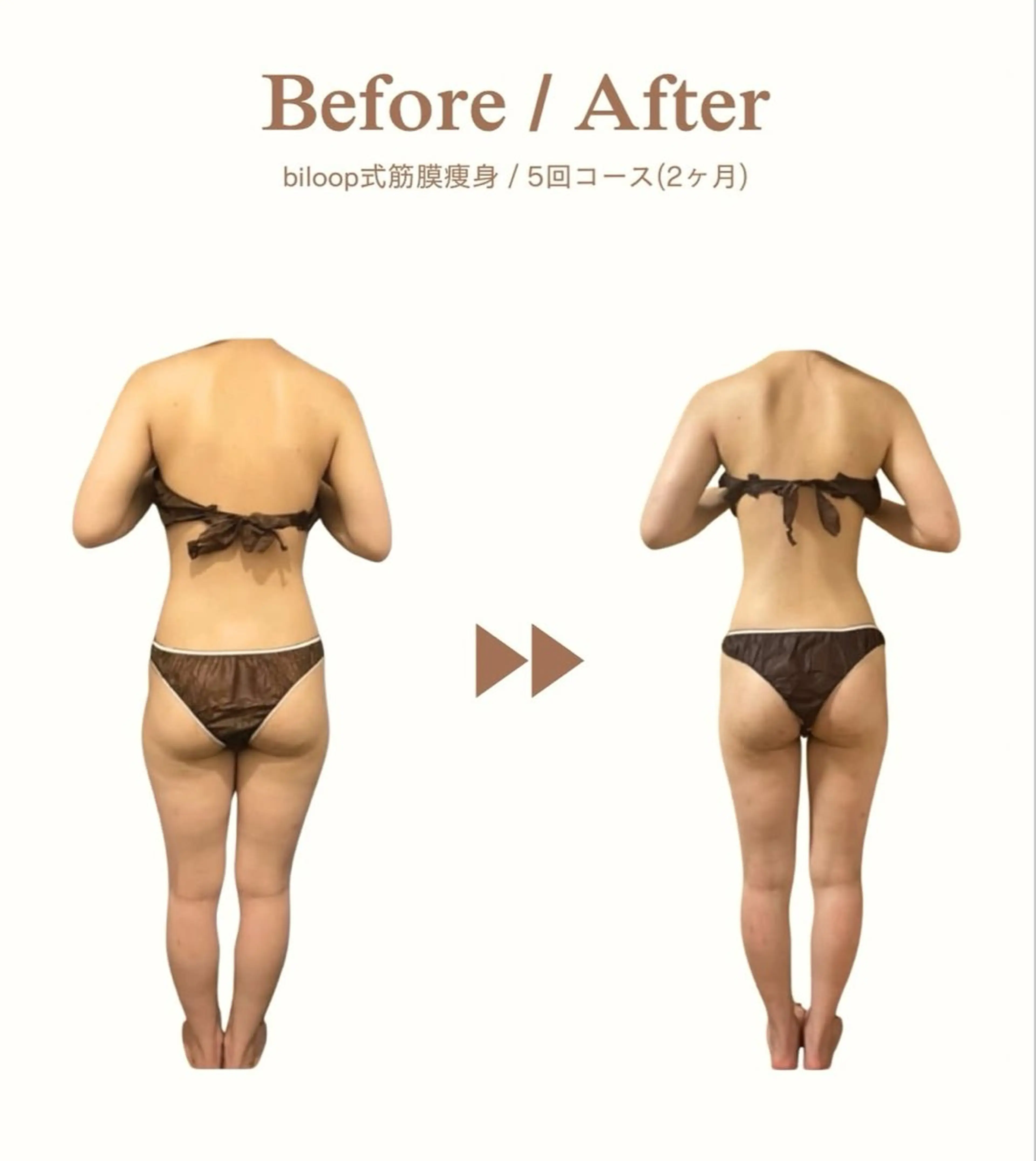 エステ リラク biloop所属・《本気痩せ×疲労改善 》  BILOOPのエステ・リラクイメージ