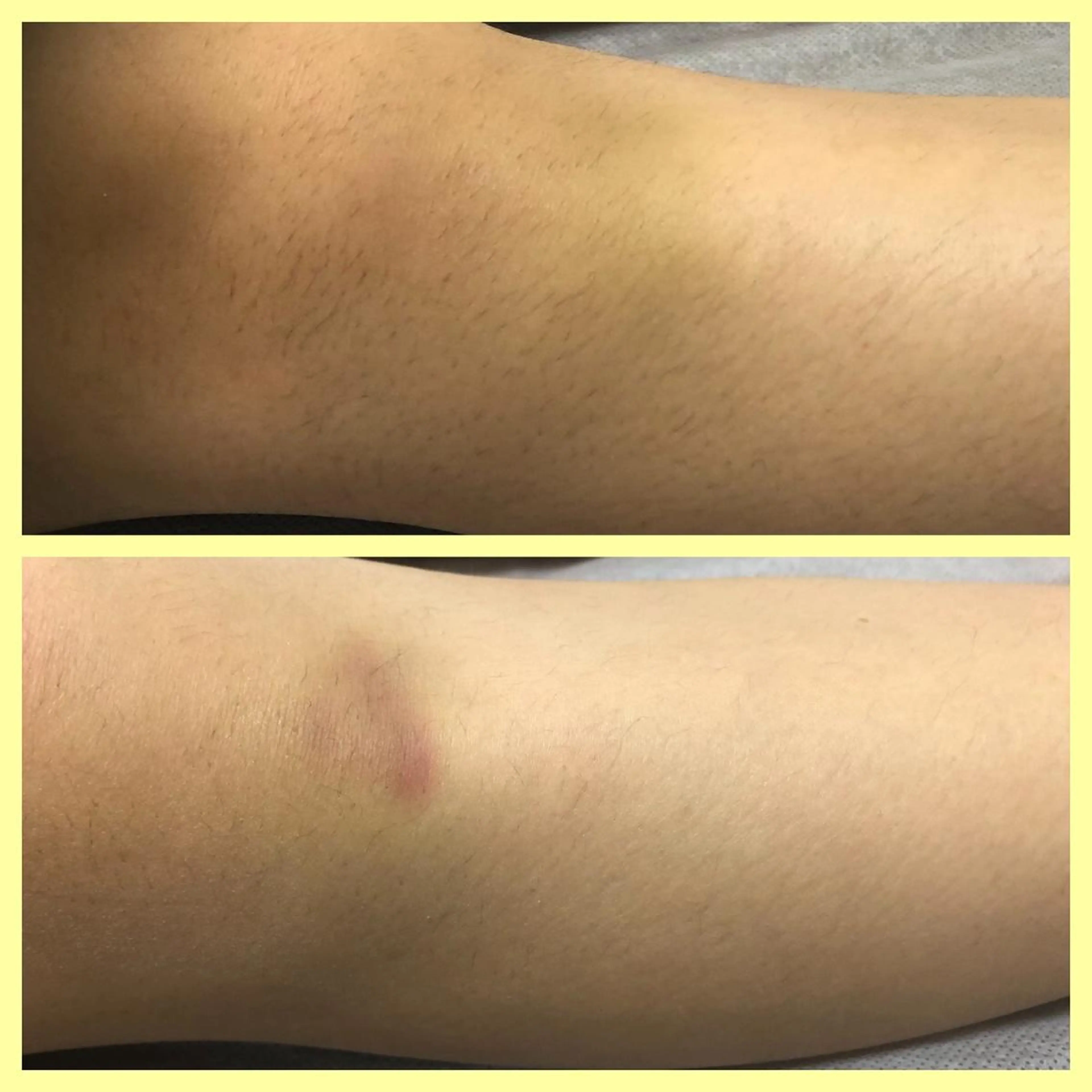 脱毛 たにがわ整骨院 salon de epila所属・salon de epilaのエステ・リラクイメージ