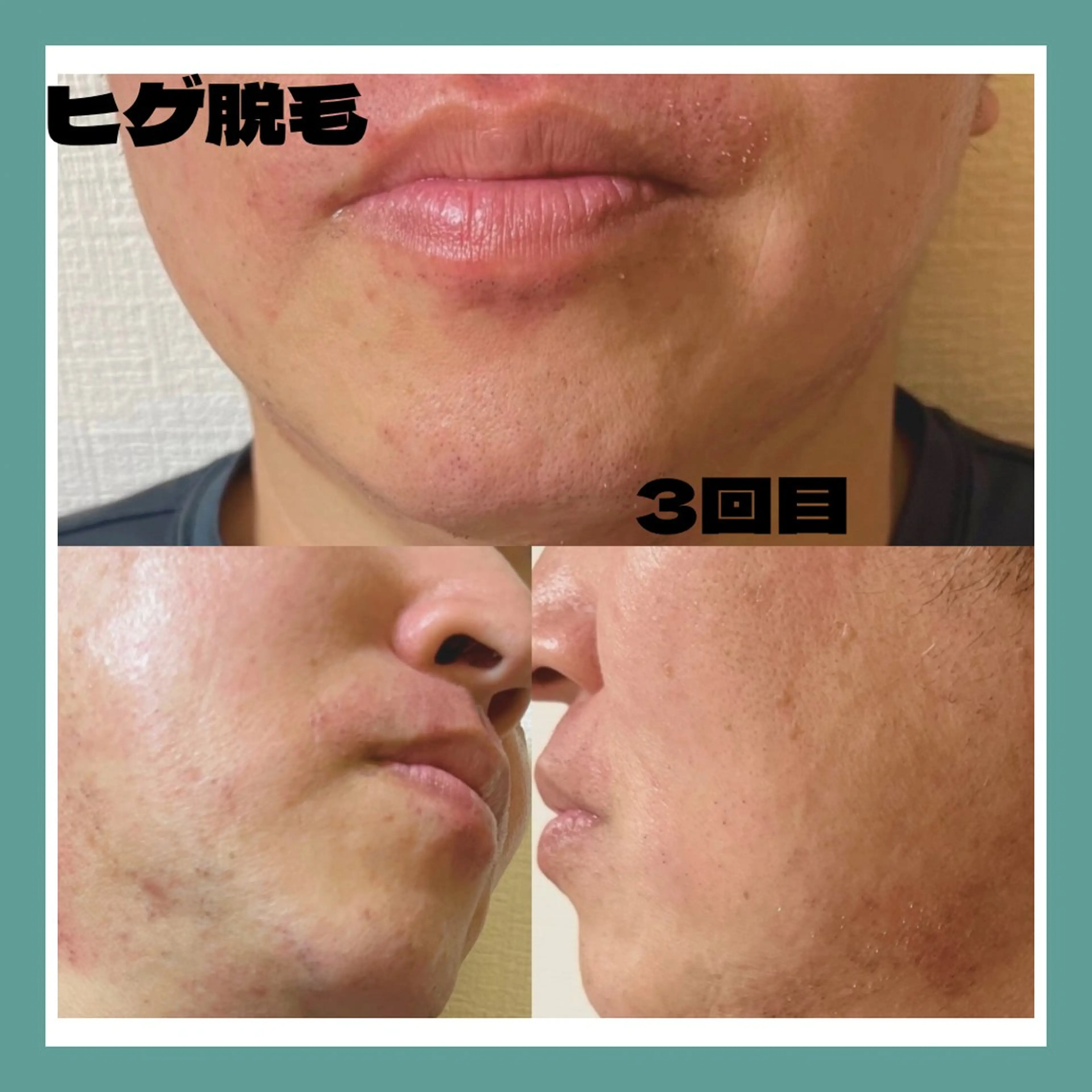 メンズ 脱毛 kaise makiのエステ・リラクイメージ