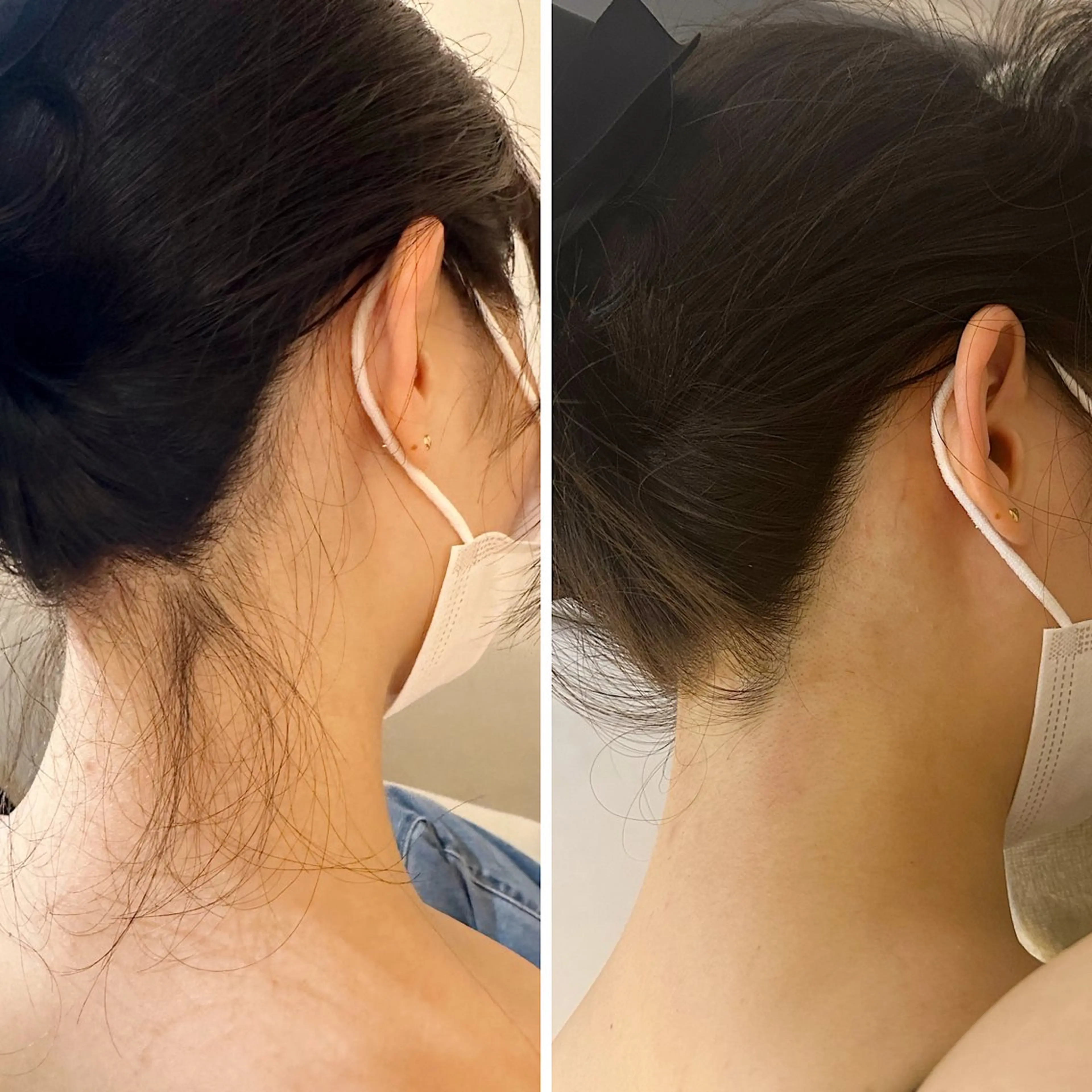 脱毛 うなじ脱毛/美肌脱毛 LABELのエステ・リラクイメージ