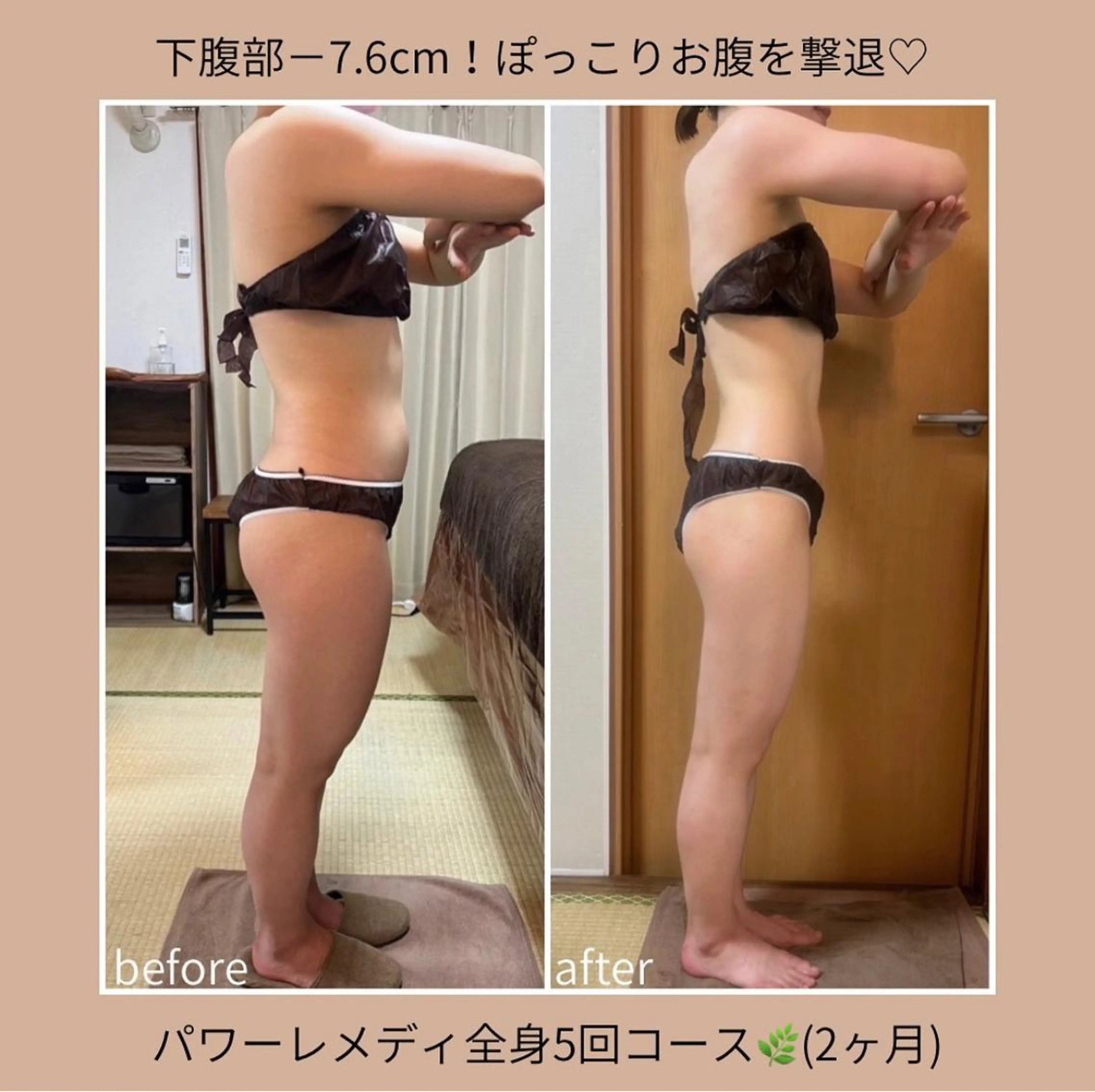 《本気痩せ×疲労改善 》  BILOOPのエステ・リラクイメージ