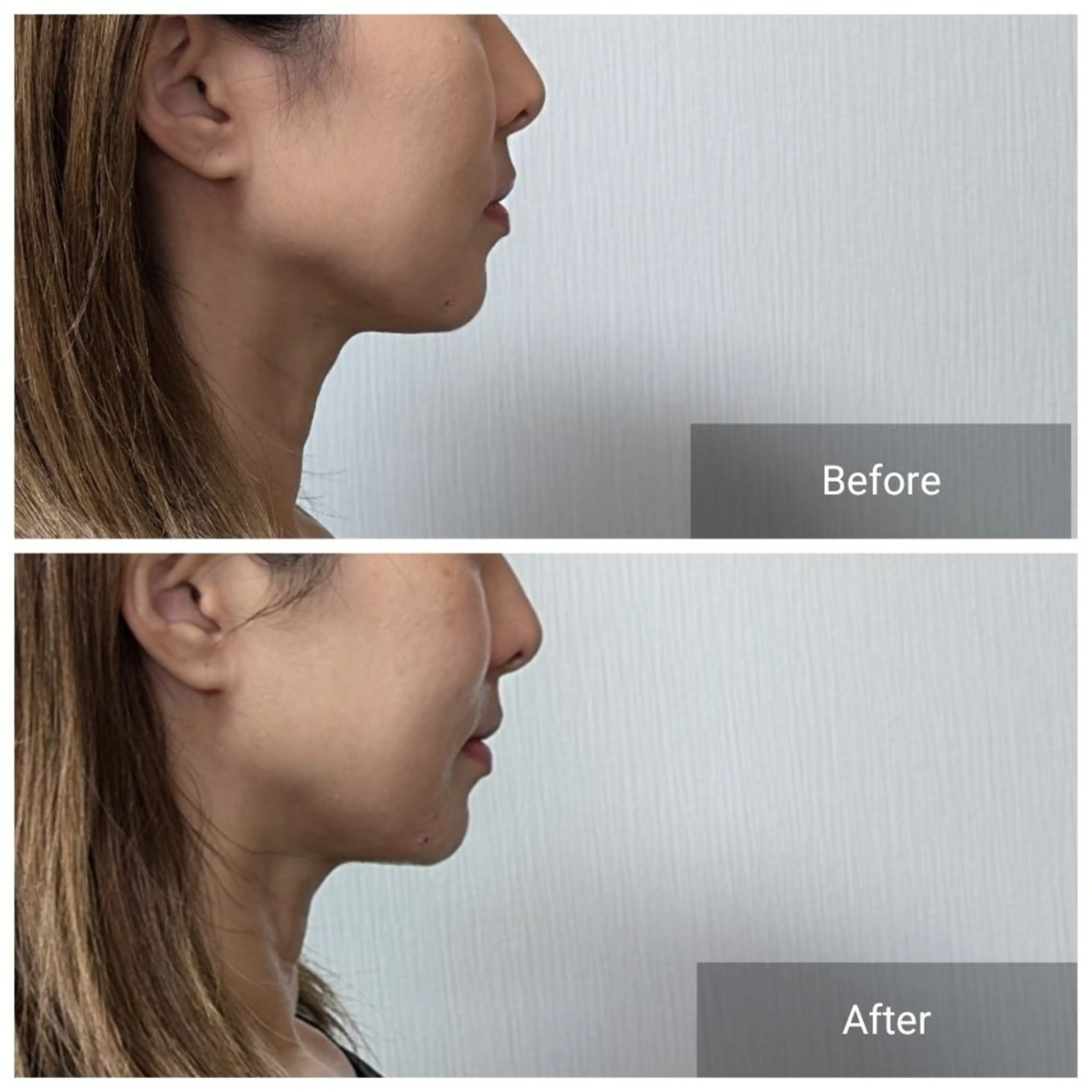 エステ nail RiRi アトレナチュラのエステ・リラクイメージ