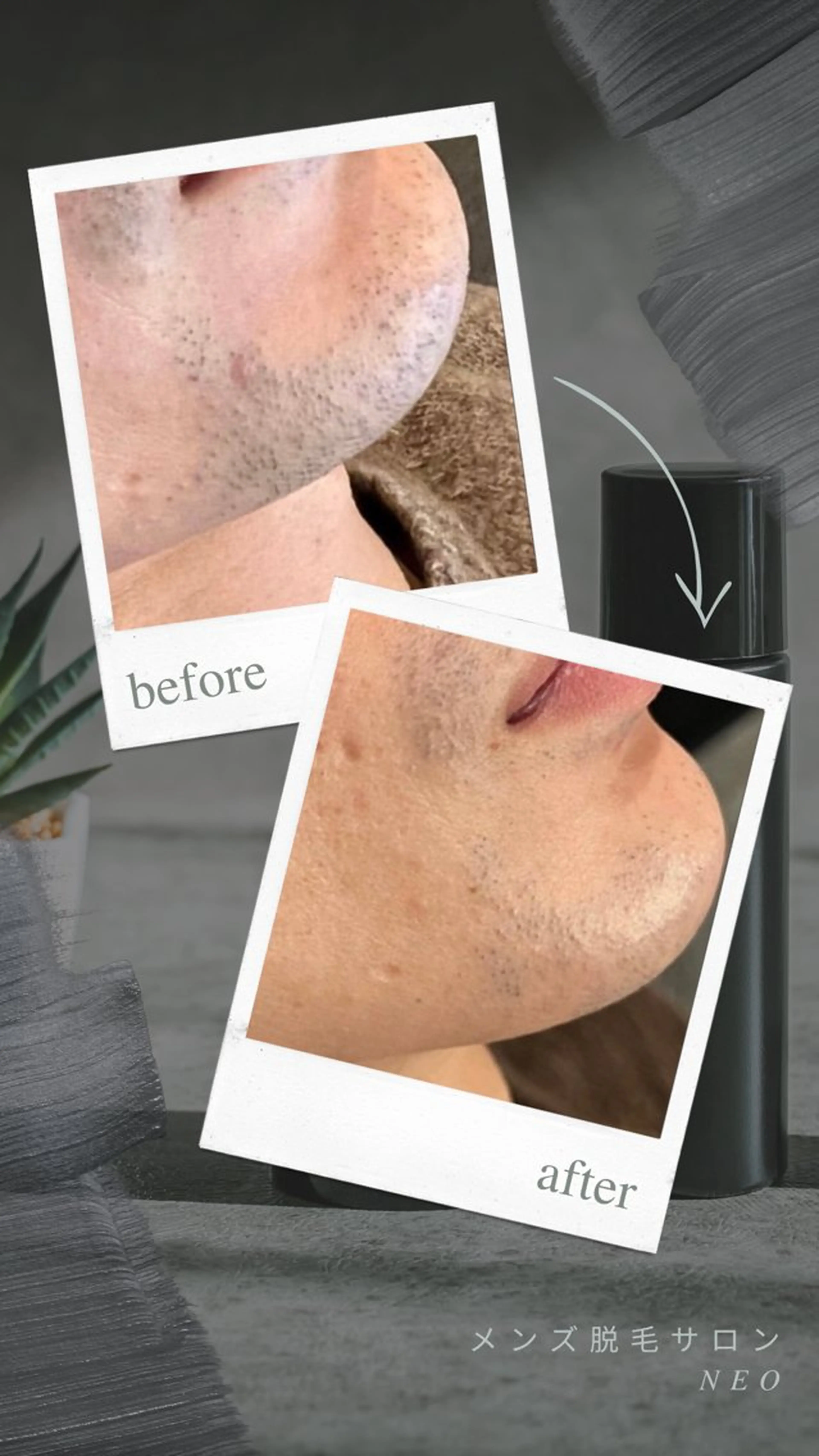 メンズ 脱毛 メンズ脱毛サロン NEOのエステ・リラクイメージ