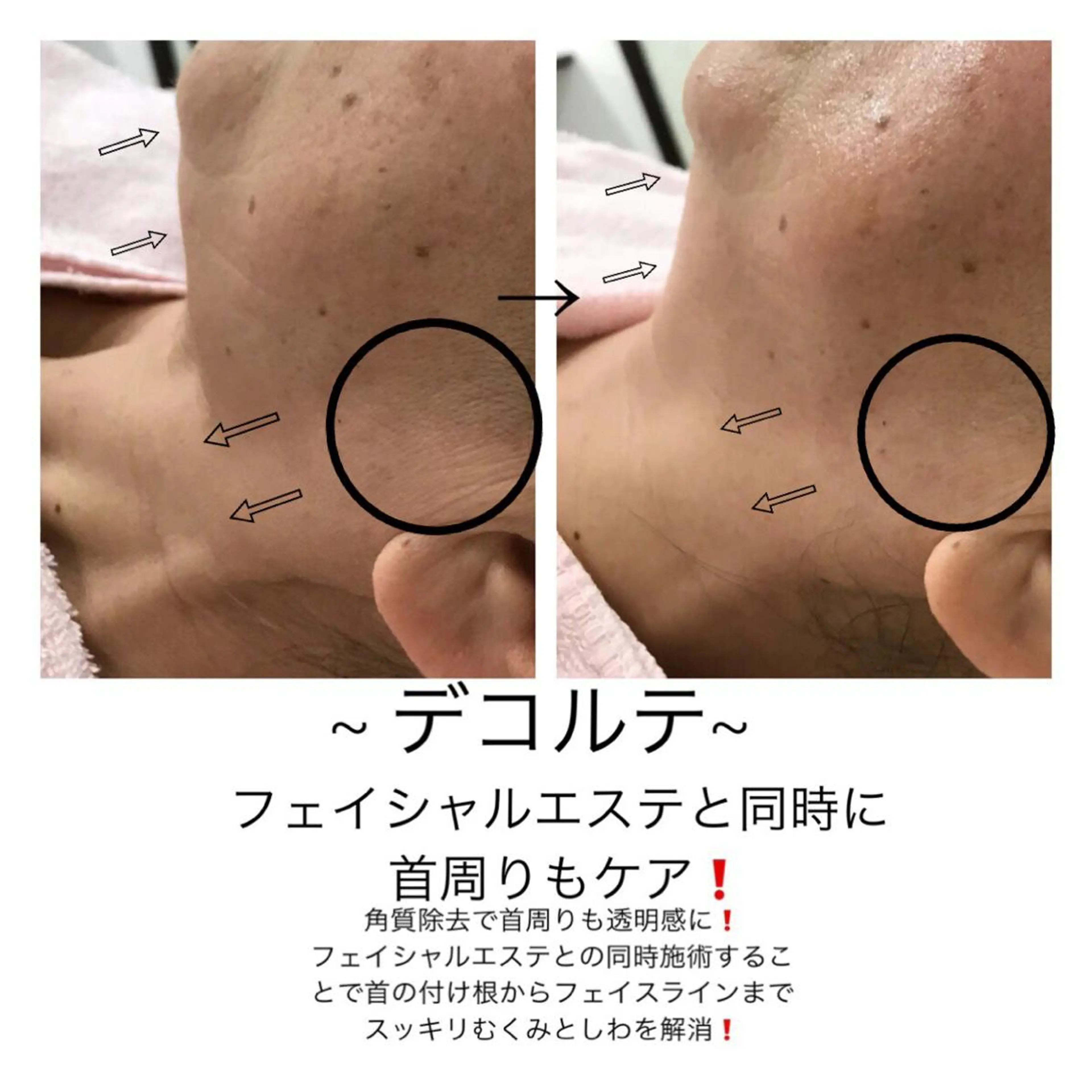 ビューティー ミロワールのエステ・リラクイメージ