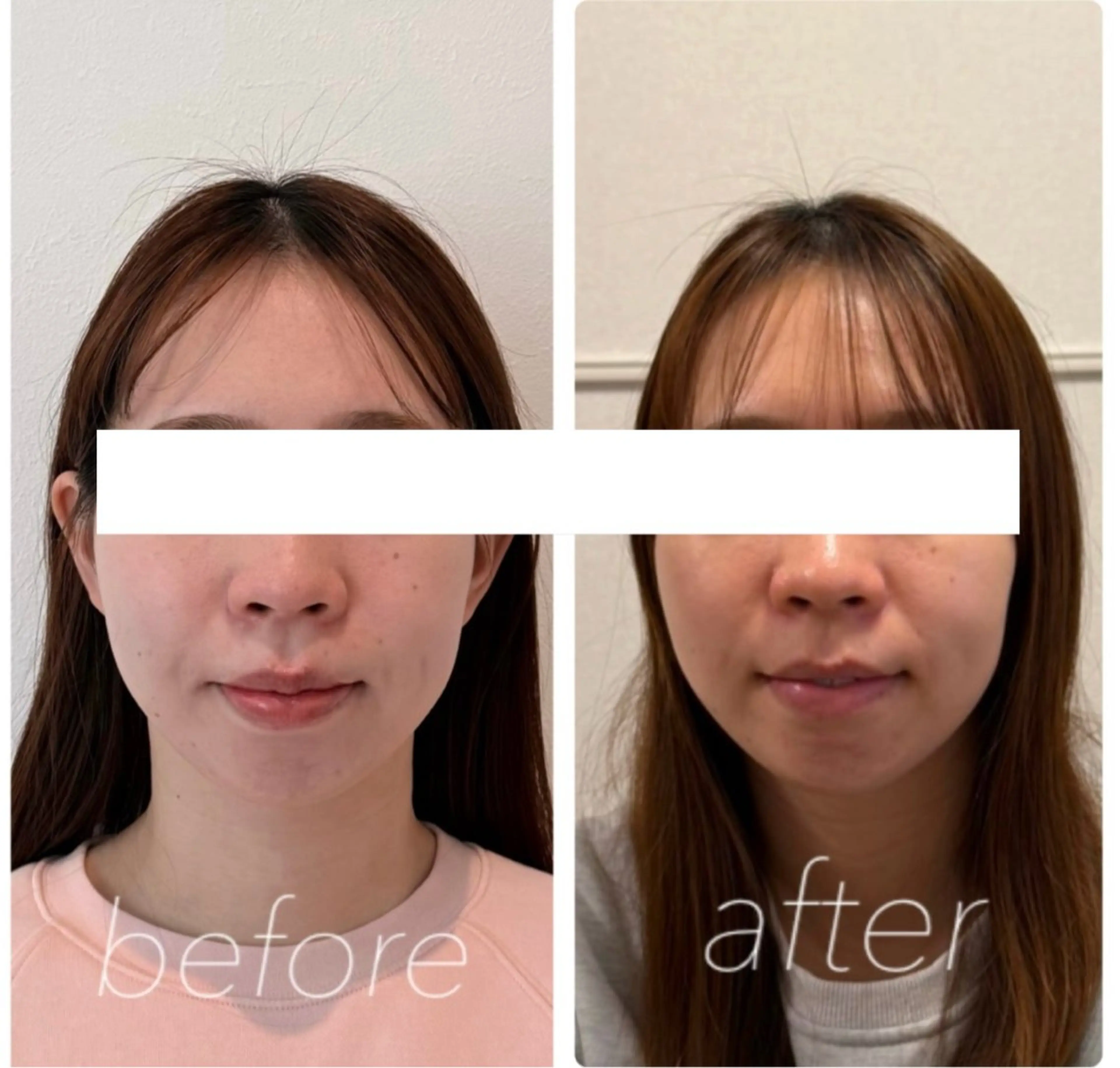 エステ リラク 小顔と ヘッドスパのお店のエステ・リラクイメージ