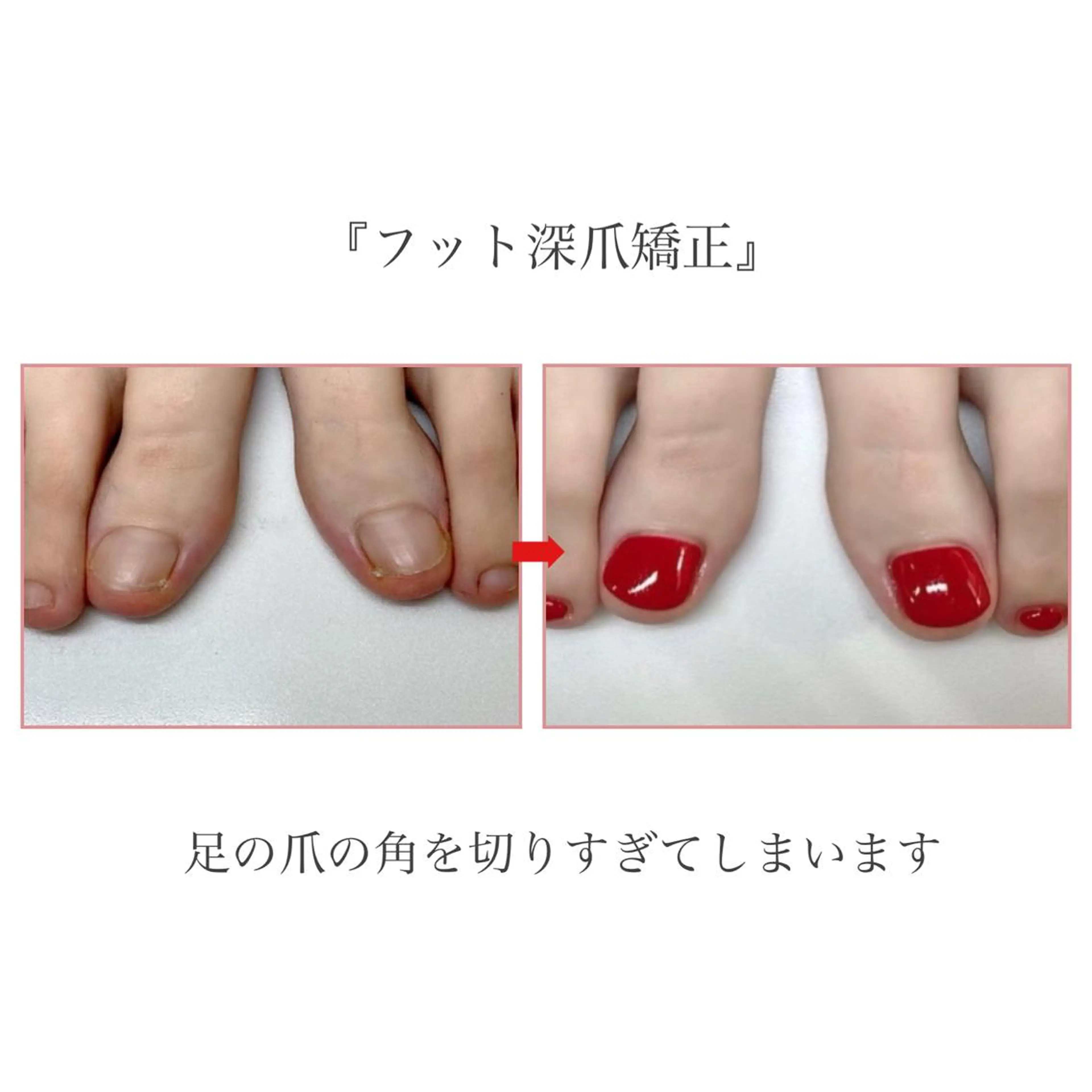 ネイル フットネイル ネイルサロン アリュームのネイルデザイン