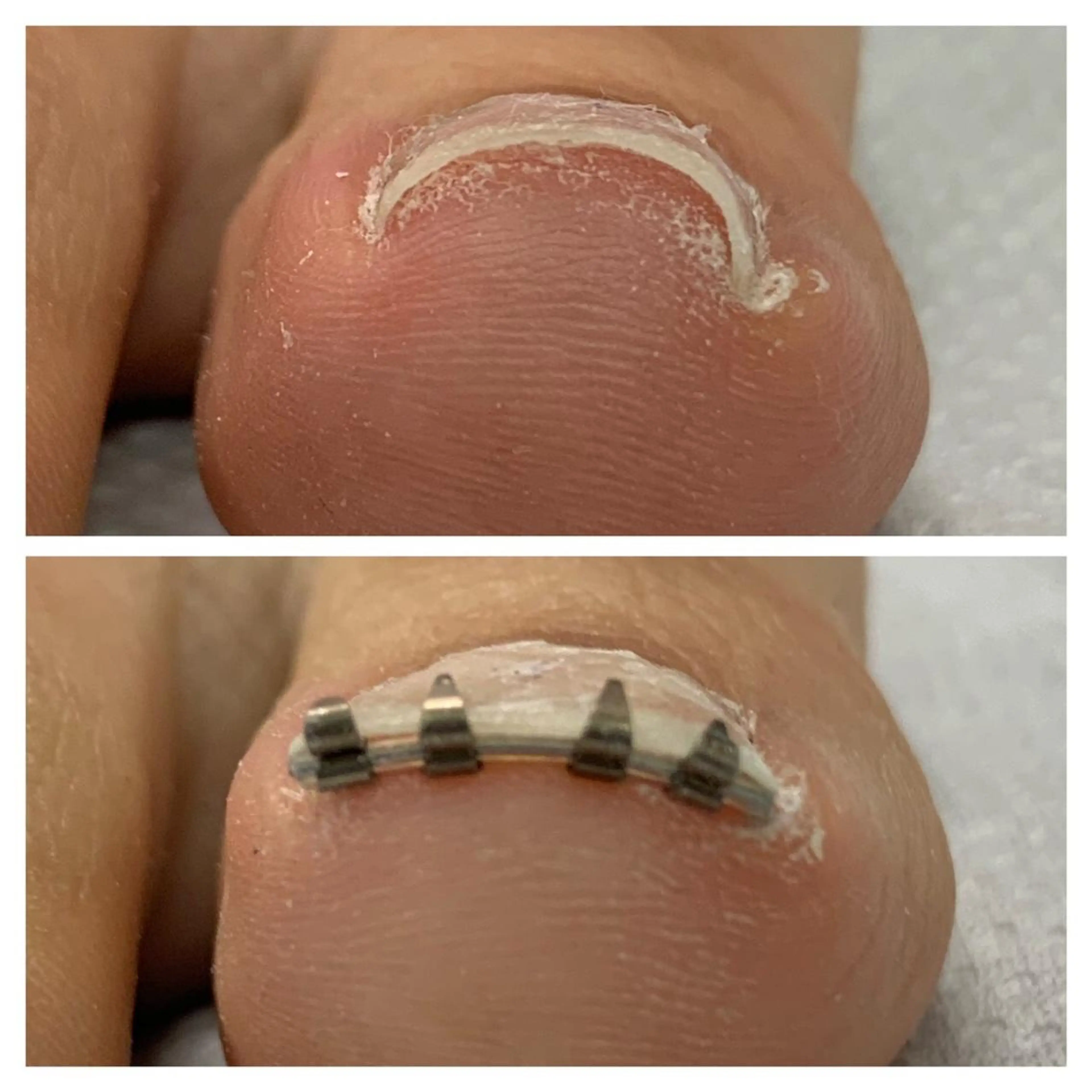 メンズ ネイル 🌱 ま し お 🌱のその他イメージ