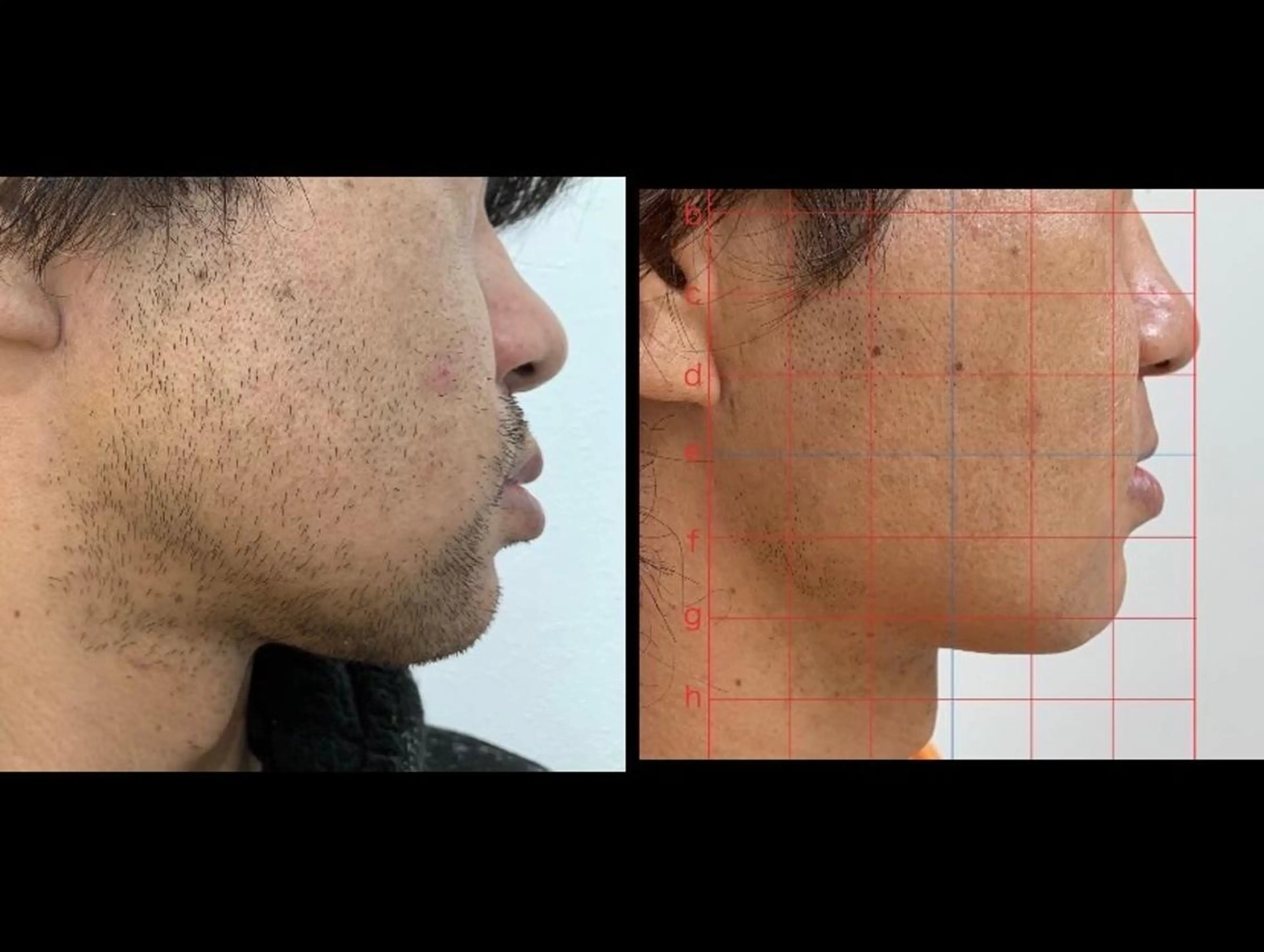 メンズ トータルビューティー サロンCherie2のエステ・リラクイメージ