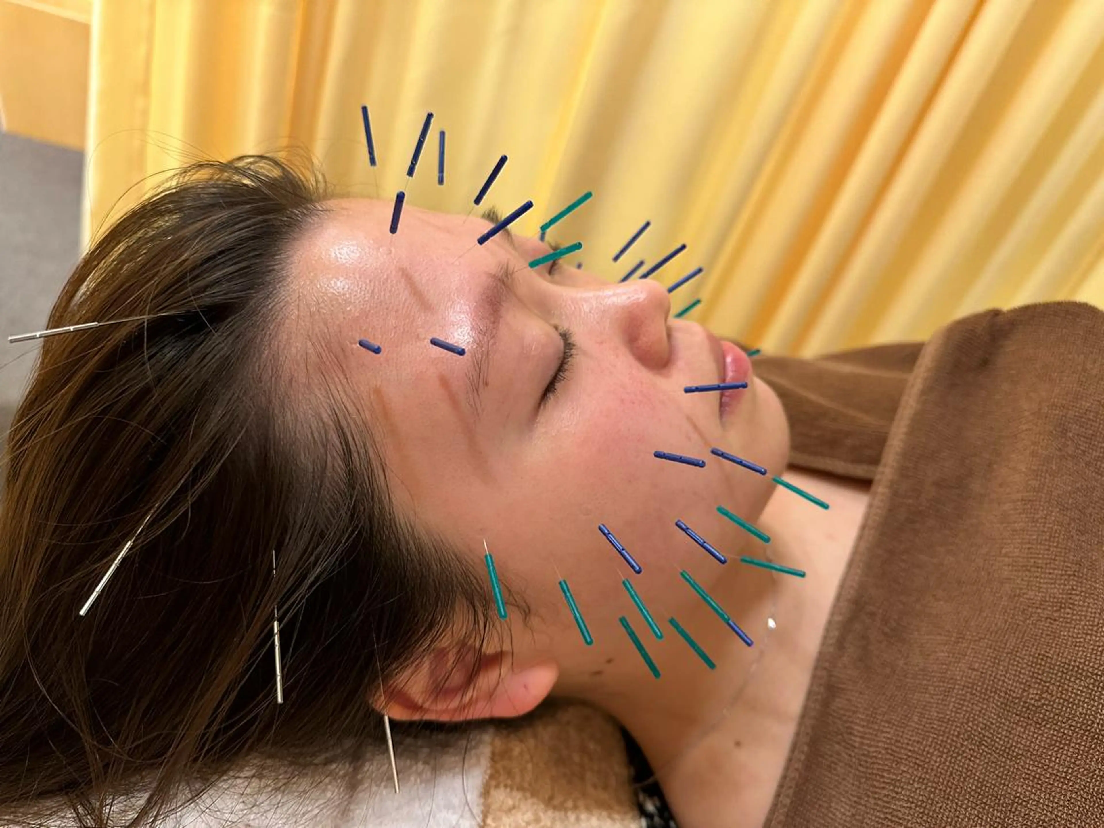 その他 鍼灸サロン BBB3のその他イメージ