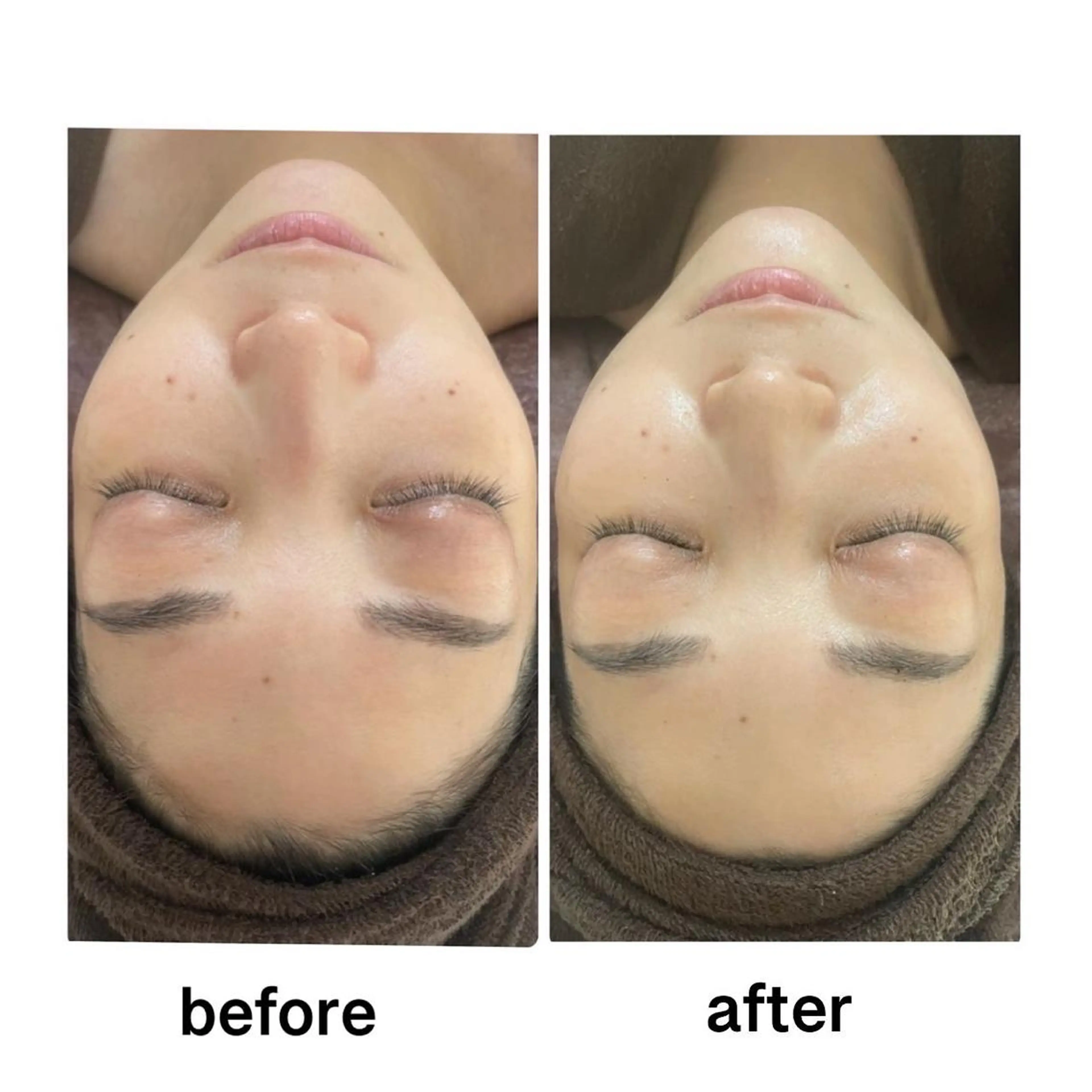 ⭐️小顔⭐️リフトアップフェイシャルマッサージ90分の写真