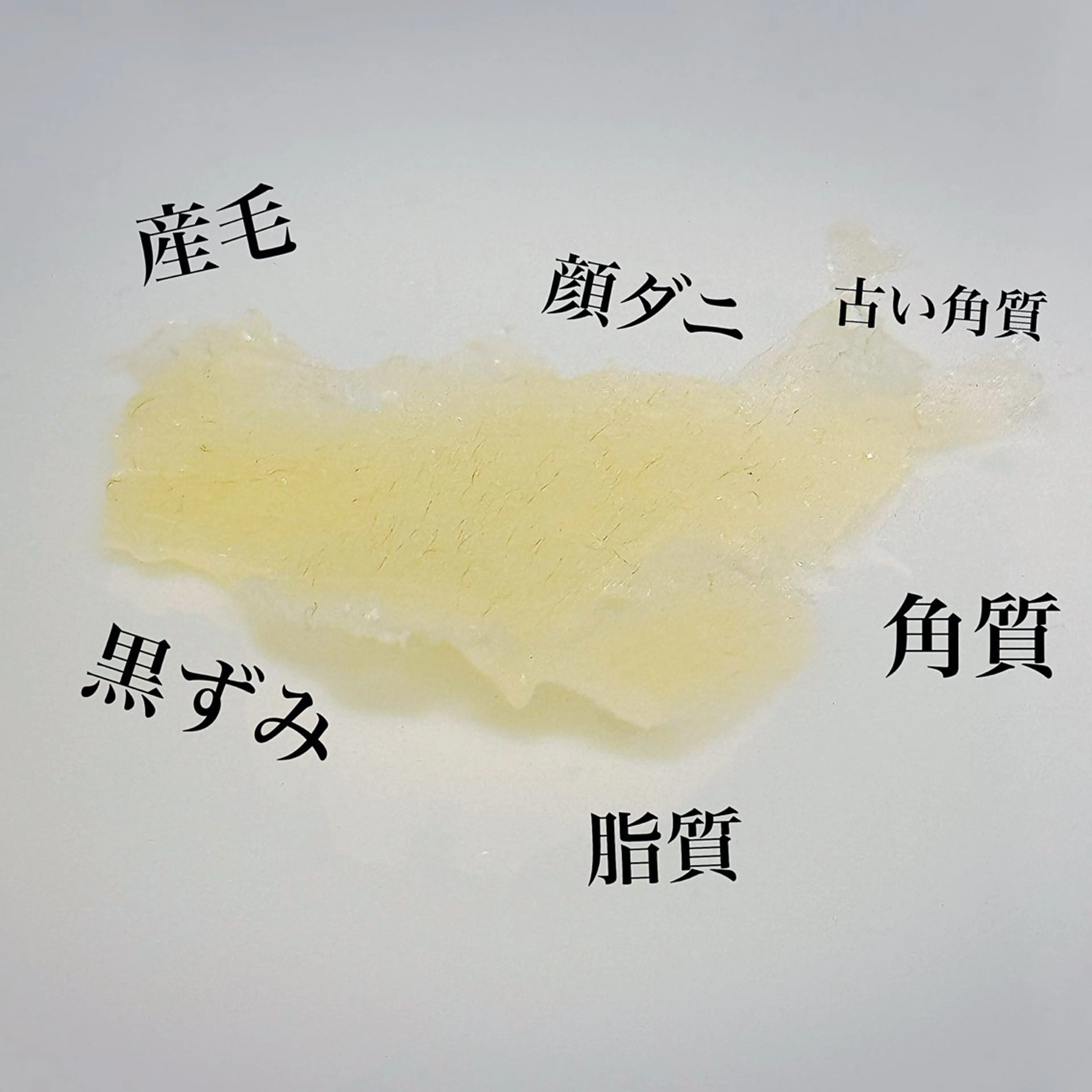 マツヤニパック部分（鼻or Tゾーンor 口周り等）の写真