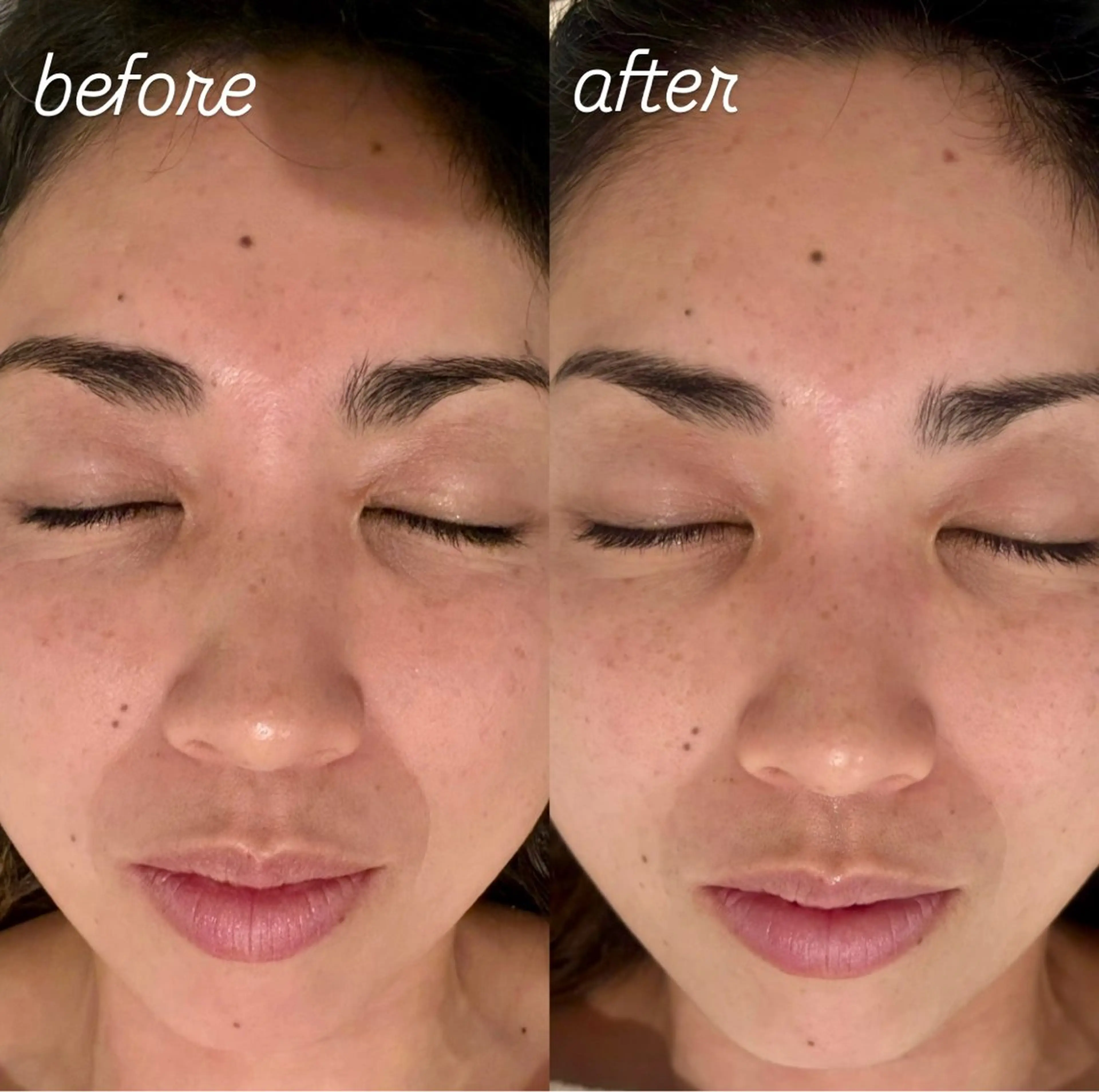 エステ リラク 肌管理🌿毛穴改善 POLA堺東のエステ・リラクイメージ