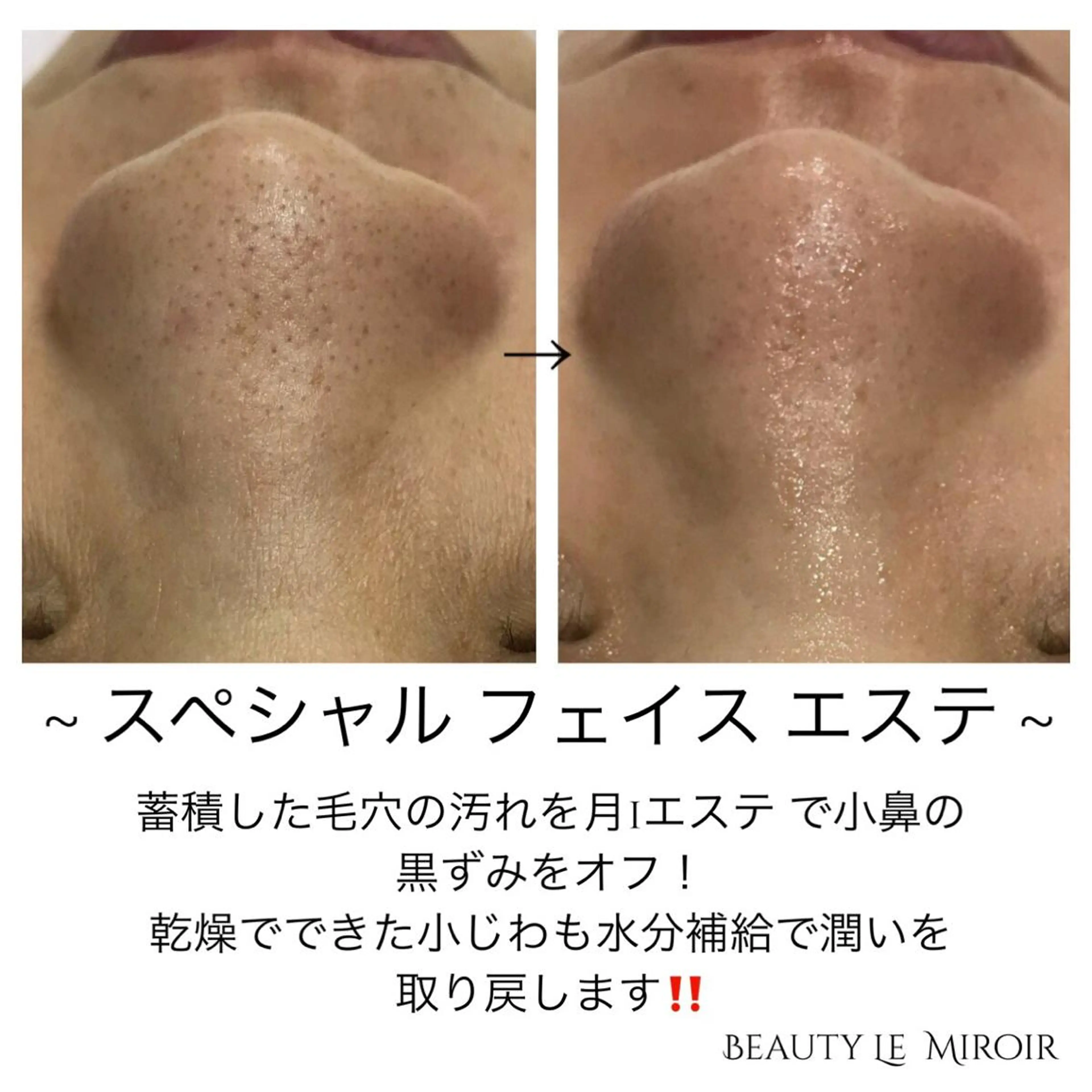 ビューティー ミロワールのエステ・リラクイメージ