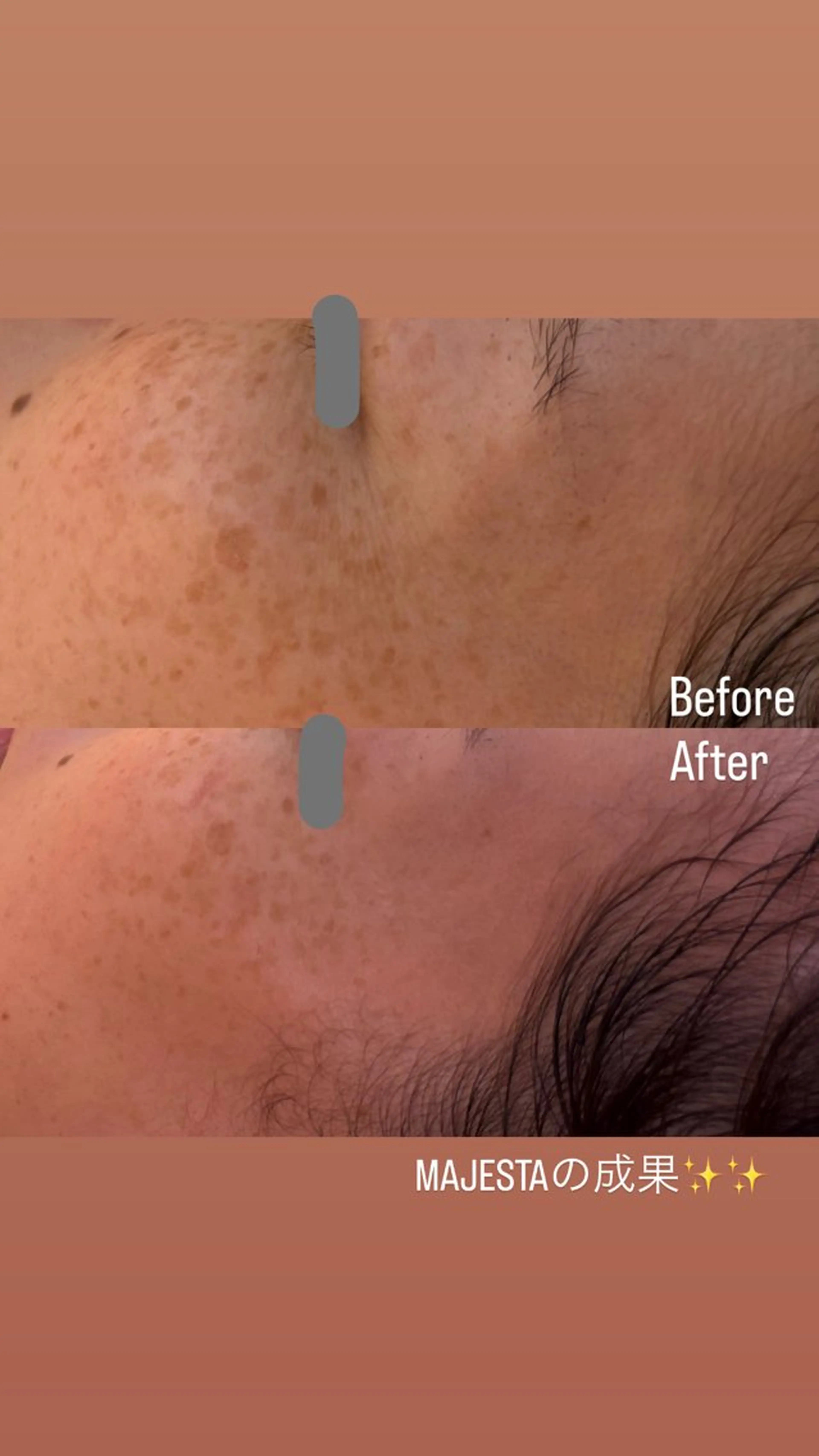 エステ リラク 中井 小春のエステ・リラクイメージ