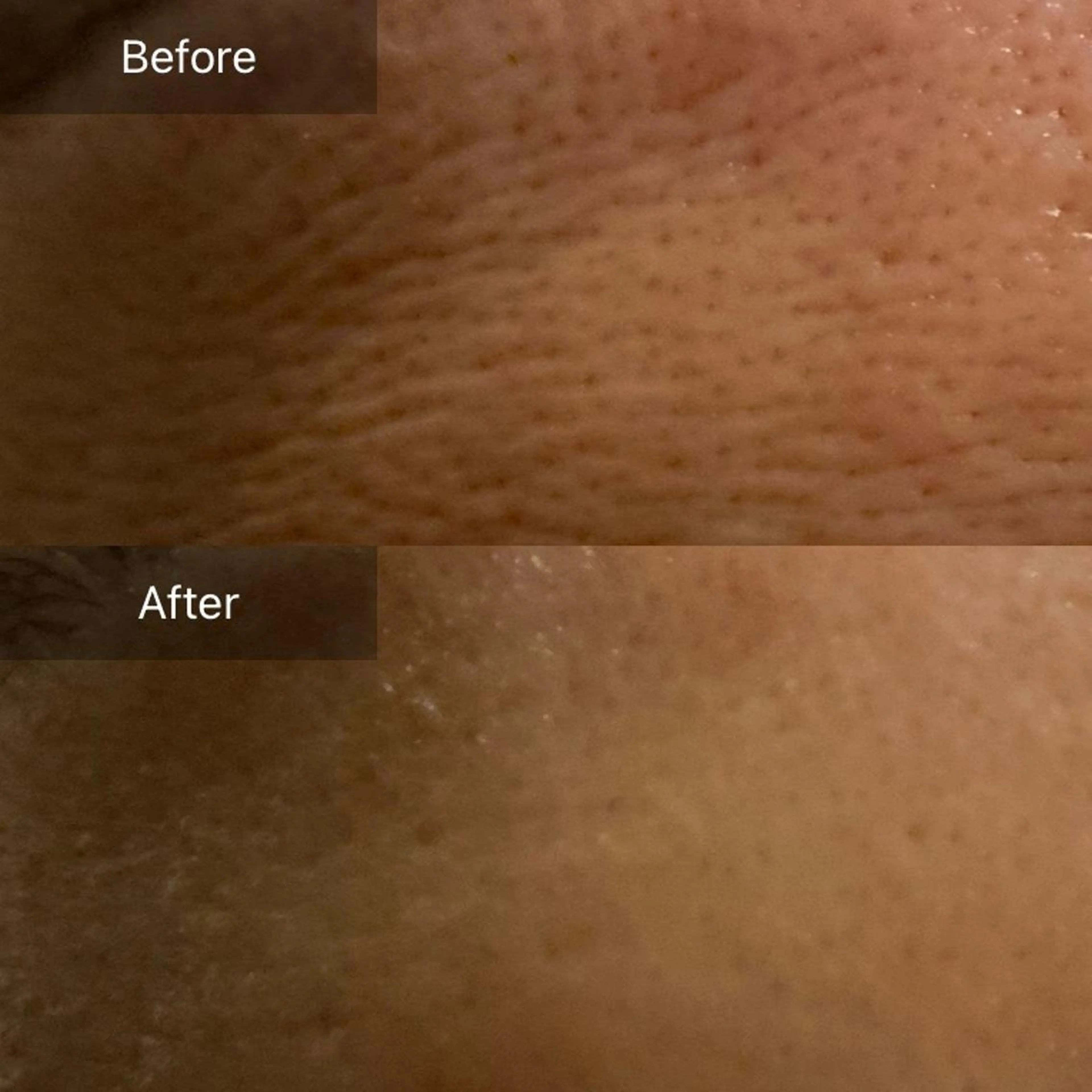 Mandarin Orange所属・毛穴から始める肌メン テマンダリンオレンジのエステ・リラクイメージ