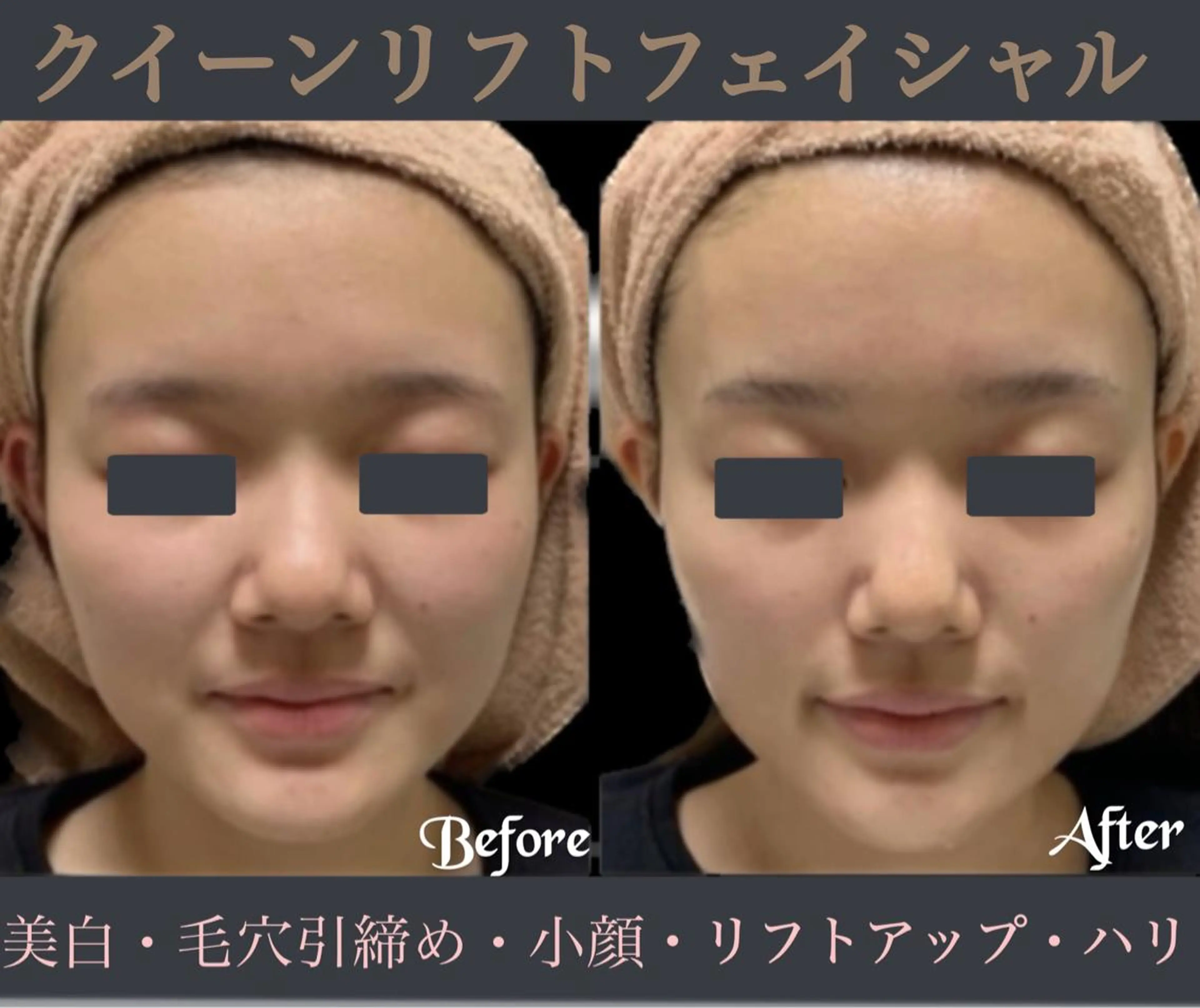 その他 ヴィーナス ビューティーのエステ・リラクイメージ