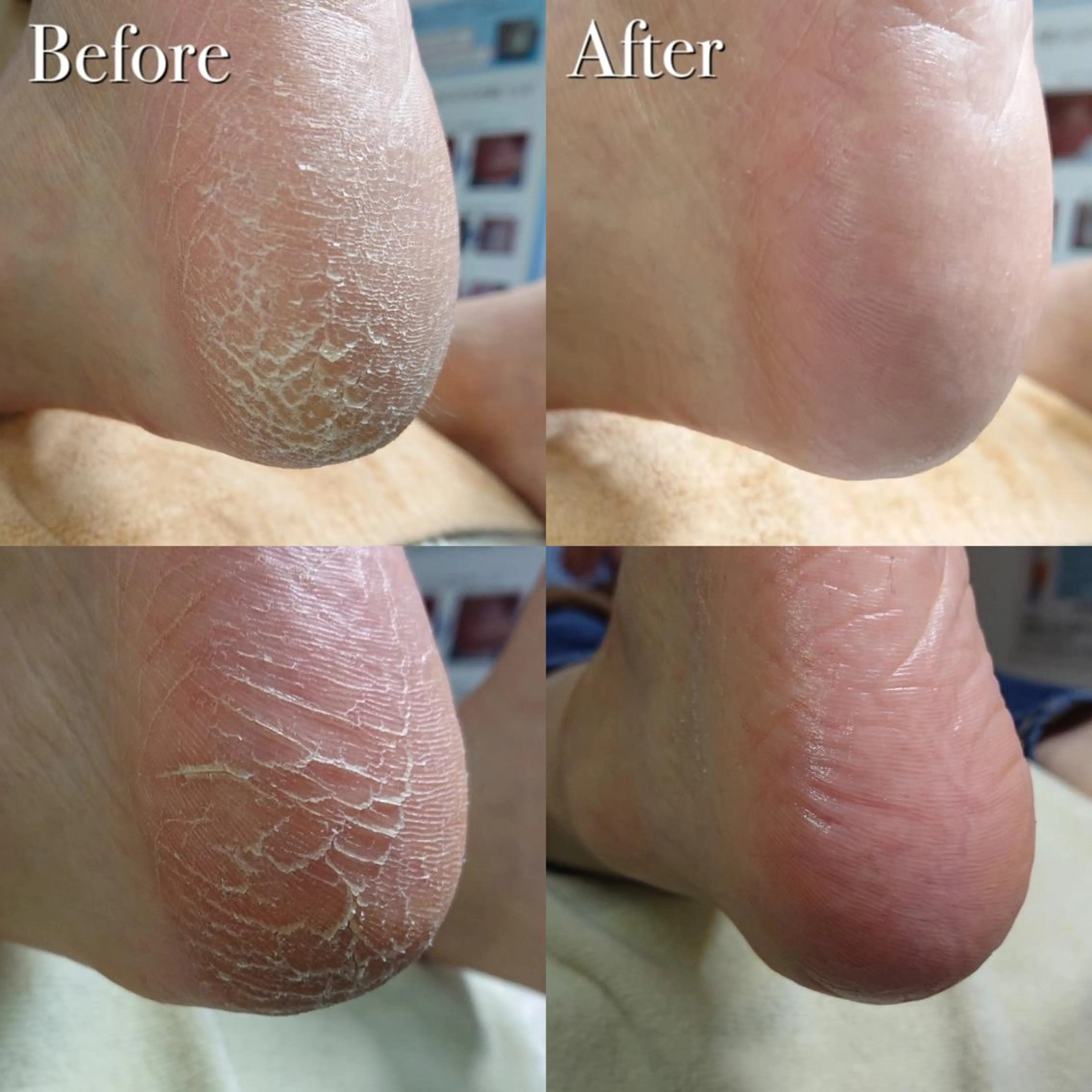 東京巻き爪アカデミー所属・東京巻き爪 アカデミーのエステ・リラクイメージ