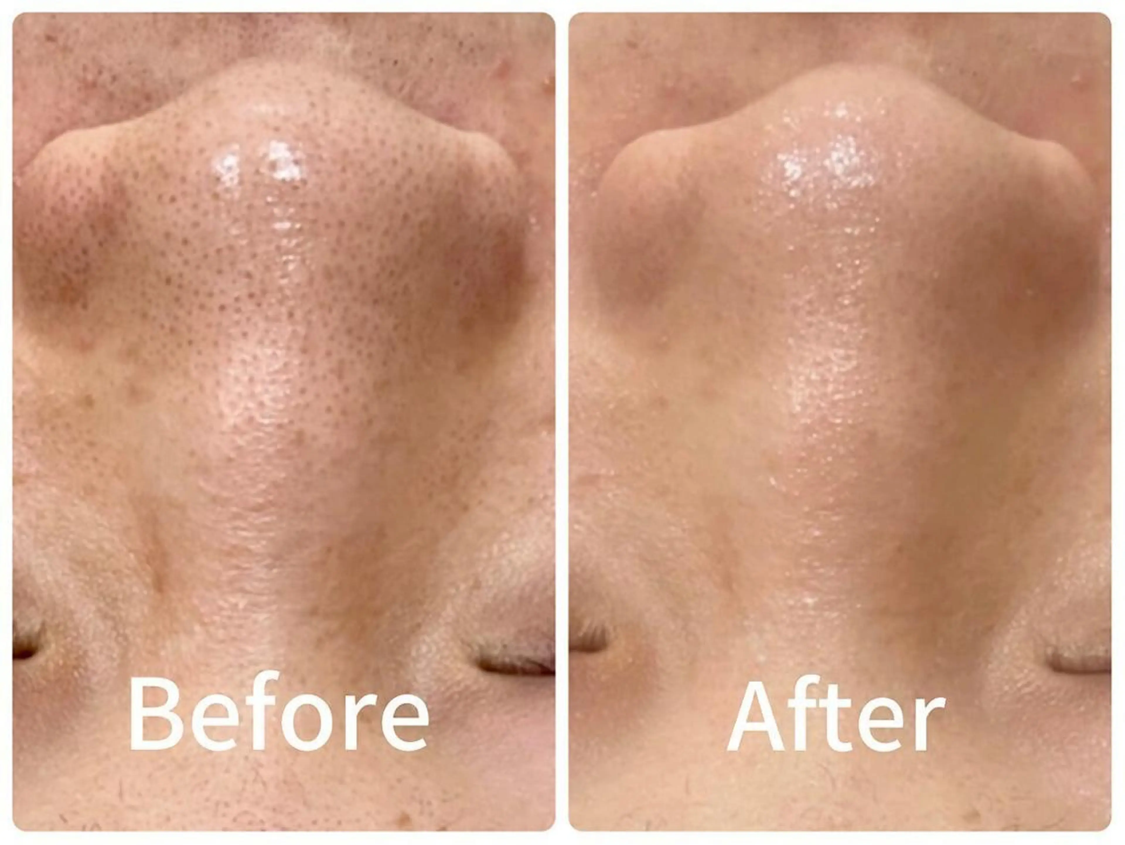 エステ 産後/ツヤ肌/子連れ /保育士在籍サロンのエステ・リラクイメージ