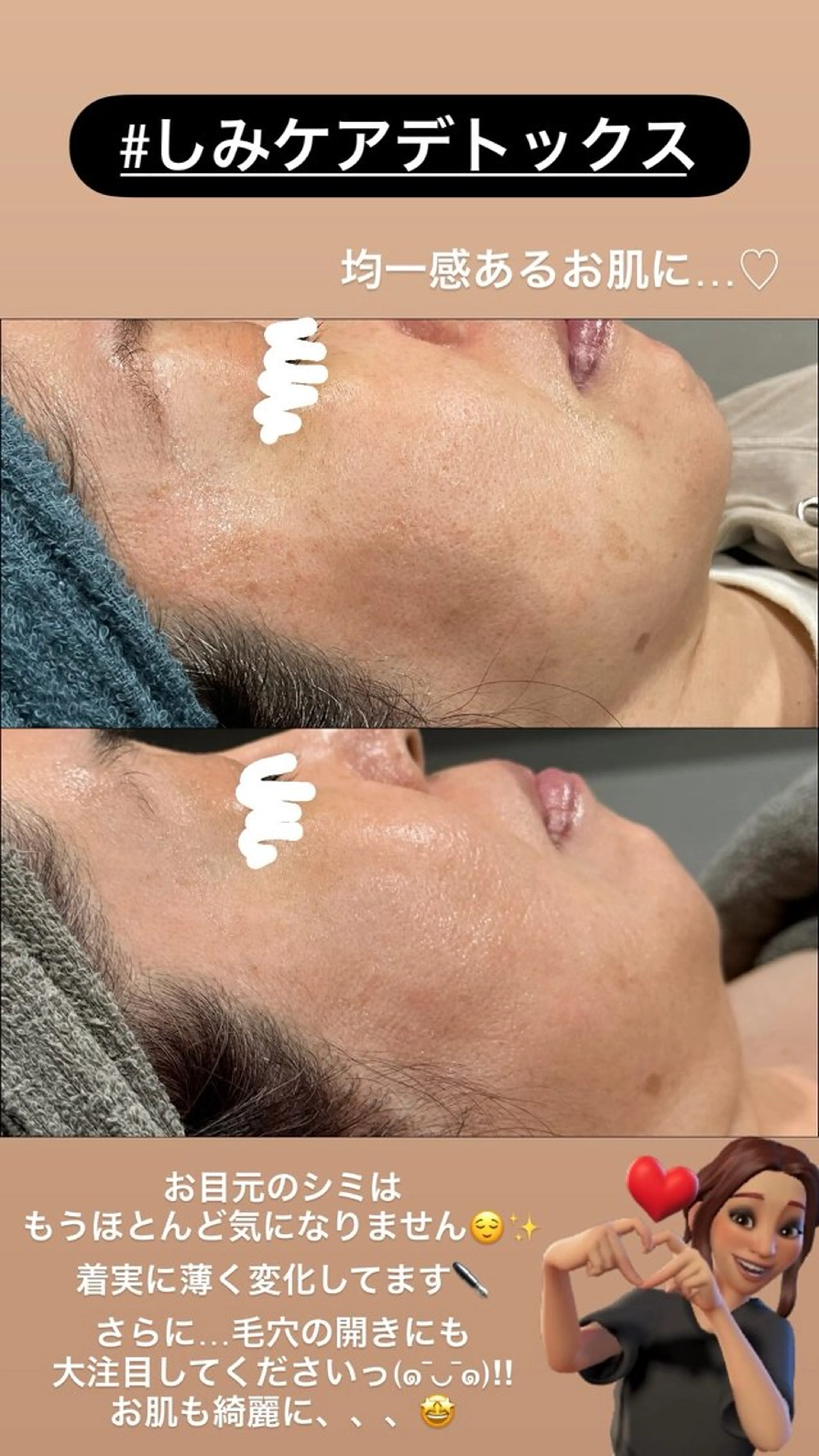 エステ LiZA エステティックサロンのエステ・リラクイメージ