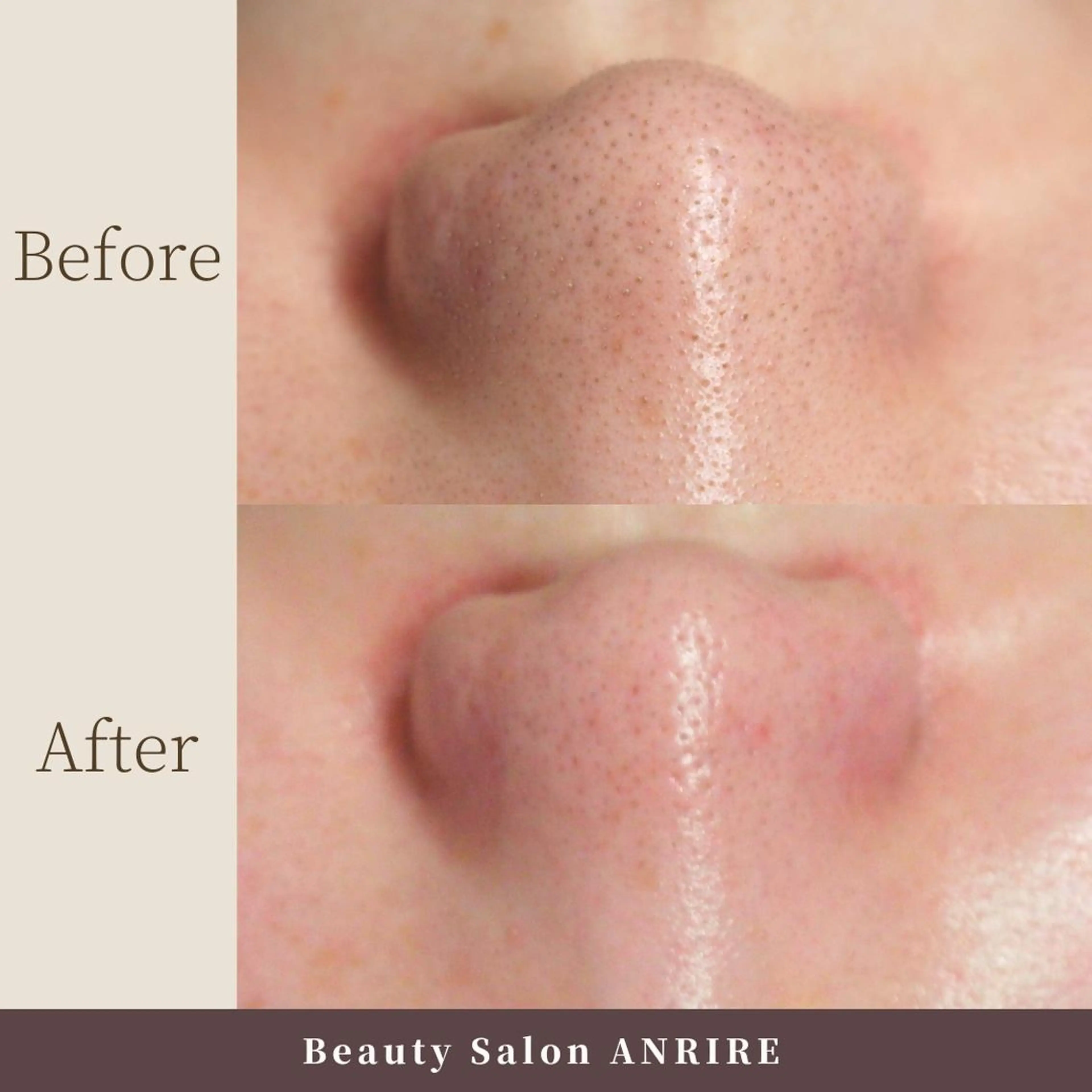 ANRIRE (アンリール)のエステ・リラクイメージ