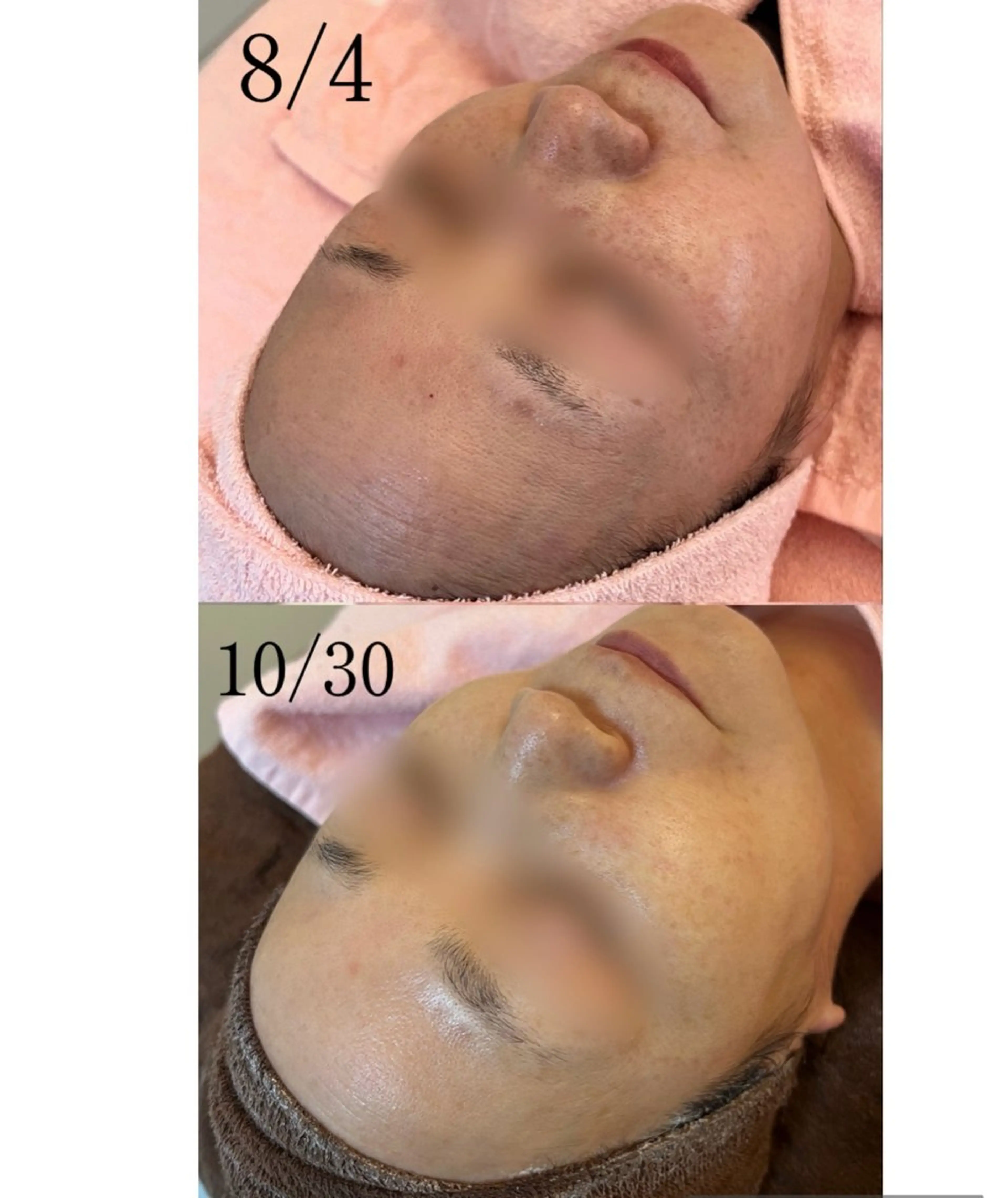 肌質改善|美眉サロン Cannone’のエステ・リラクイメージ