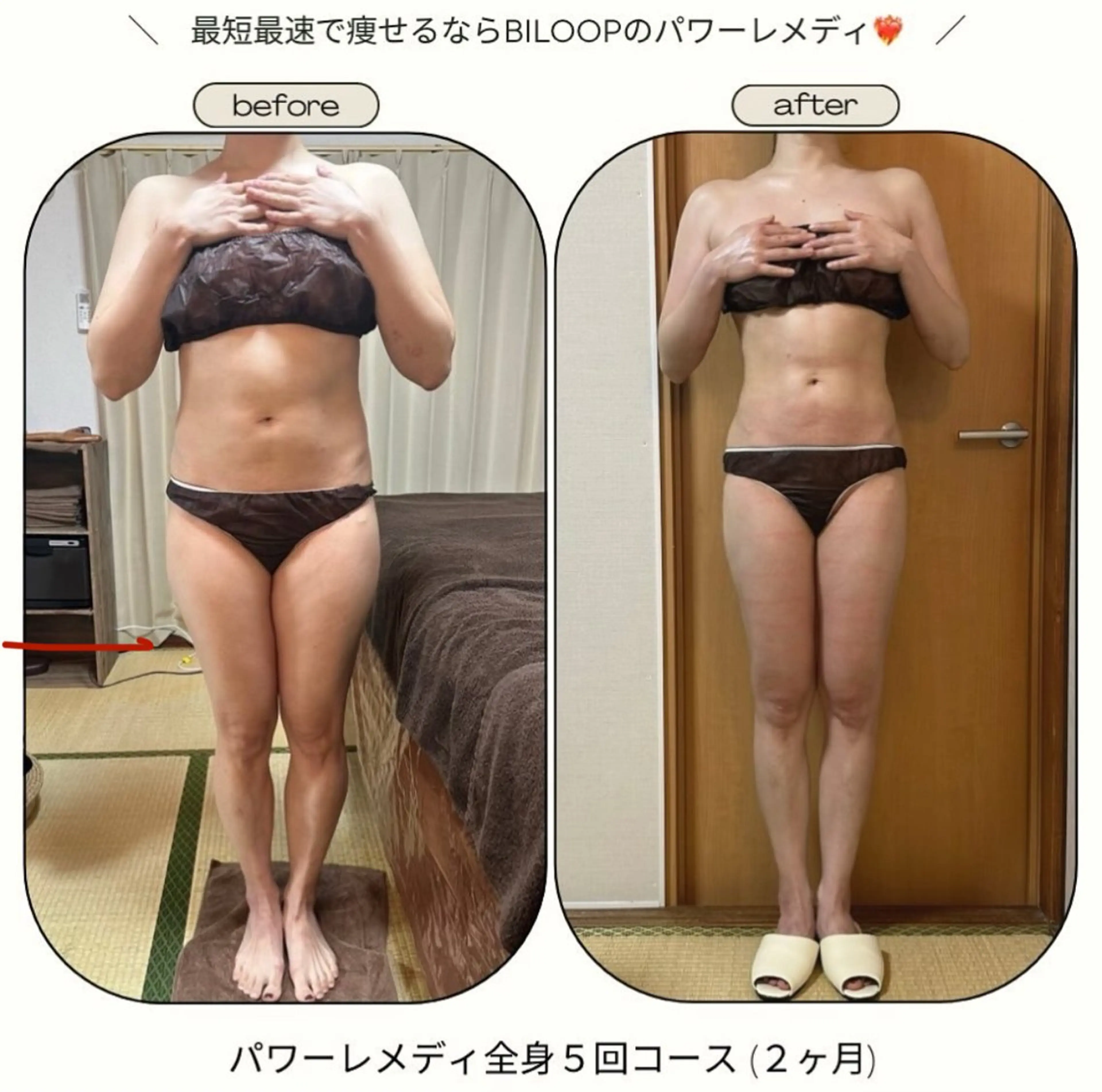 《本気痩せ×疲労改善 》  BILOOPのエステ・リラクイメージ